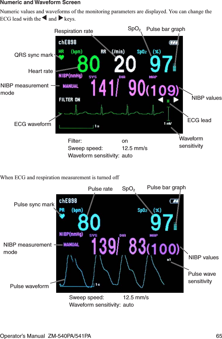 Operator’s Manual  ZM-540PA/541PA  65Numeric and Waveform ScreenNumeric values and waveforms of the monitoring parameters are displayed. You can change the ECG lead with the ▼ and ▼ keys.Heart rateQRS sync markPulse bar graphSpO2Respiration rateNIBP valuesECG waveformFilter: onSweep speed:  12.5 mm/sWaveform sensitivity:  autoWaveform sensitivityECG leadNIBP measurement modeWhen ECG and respiration measurement is turned offPulse ratePulse sync markPulse bar graphSpO2Pulse wave sensitivityPulse waveformSweep speed:  12.5 mm/sWaveform sensitivity:  autoNIBP valuesNIBP measurement mode
