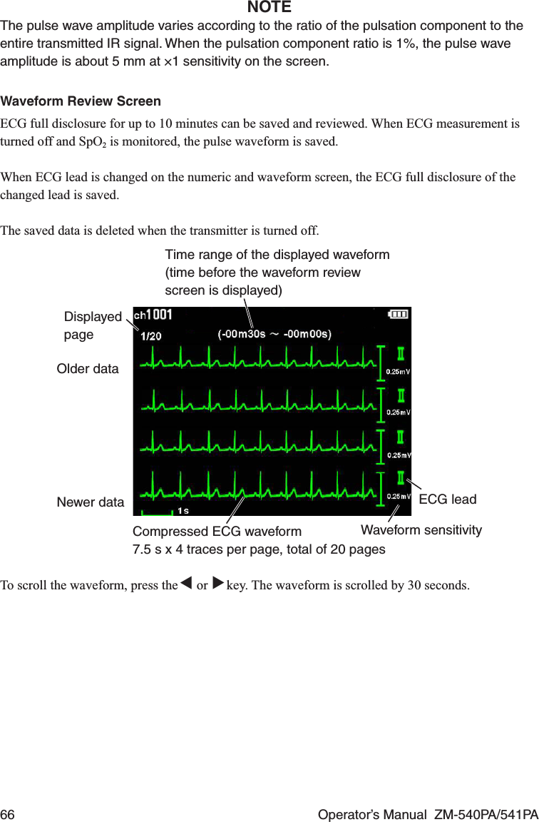 66  Operator’s Manual  ZM-540PA/541PANOTEThe pulse wave amplitude varies according to the ratio of the pulsation component to the entire transmitted IR signal. When the pulsation component ratio is 1%, the pulse wave amplitude is about 5 mm at ×1 sensitivity on the screen.Waveform Review ScreenECG full disclosure for up to 10 minutes can be saved and reviewed. When ECG measurement is turned off and SpO2 is monitored, the pulse waveform is saved.When ECG lead is changed on the numeric and waveform screen, the ECG full disclosure of the changed lead is saved.The saved data is deleted when the transmitter is turned off.ECG leadDisplayed pageCompressed ECG waveform7.5 s x 4 traces per page, total of 20 pagesOlder dataNewer dataTime range of the displayed waveform (time before the waveform review screen is displayed)Waveform sensitivityTo scroll the waveform, press the ▼ or ▼ key. The waveform is scrolled by 30 seconds.