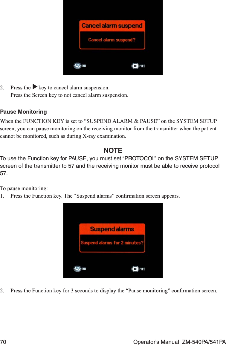 70  Operator’s Manual  ZM-540PA/541PA2. Press the ▼ key to cancel alarm suspension.  Press the Screen key to not cancel alarm suspension.Pause MonitoringWhen the FUNCTION KEY is set to “SUSPEND ALARM &amp; PAUSE” on the SYSTEM SETUP screen, you can pause monitoring on the receiving monitor from the transmitter when the patient cannot be monitored, such as during X-ray examination.NOTETo use the Function key for PAUSE, you must set “PROTOCOL” on the SYSTEM SETUP screen of the transmitter to 57 and the receiving monitor must be able to receive protocol 57.To pause monitoring:1.  Press the Function key. The “Suspend alarms” conﬁrmation screen appears.2.  Press the Function key for 3 seconds to display the “Pause monitoring” conﬁrmation screen.