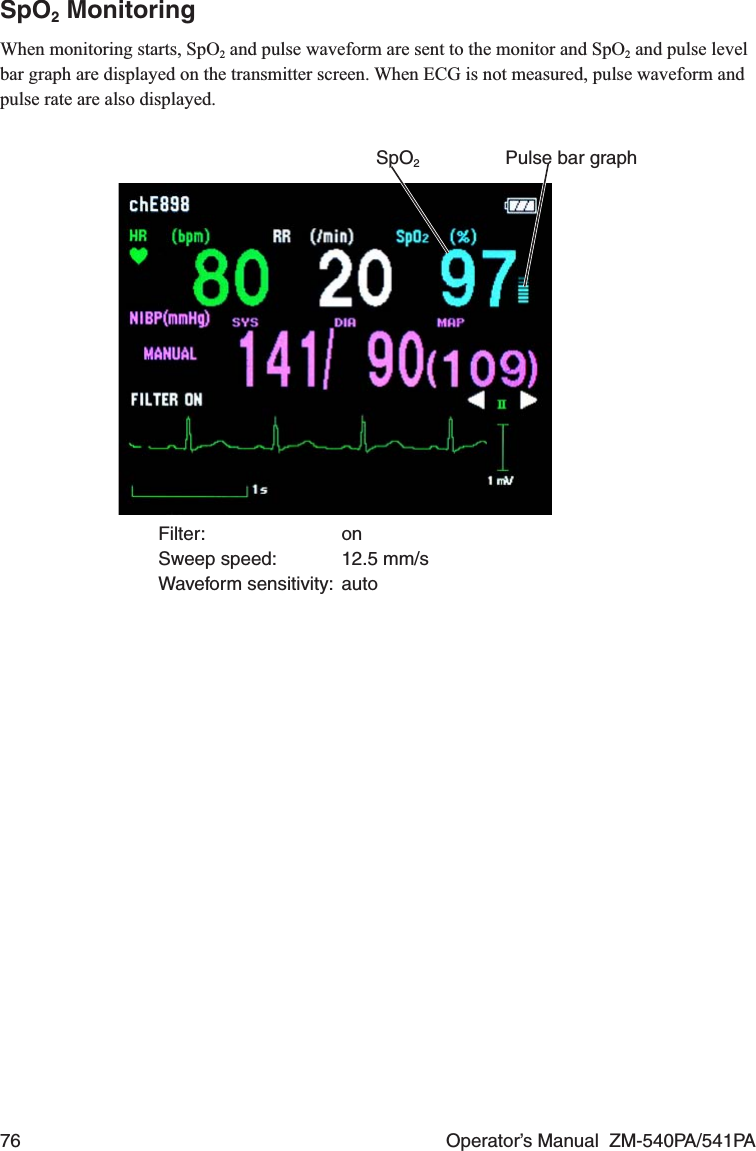 76  Operator’s Manual  ZM-540PA/541PASpO2 MonitoringWhen monitoring starts, SpO2 and pulse waveform are sent to the monitor and SpO2 and pulse level bar graph are displayed on the transmitter screen. When ECG is not measured, pulse waveform and pulse rate are also displayed.Pulse bar graphSpO2Filter: onSweep speed:  12.5 mm/sWaveform sensitivity:  auto
