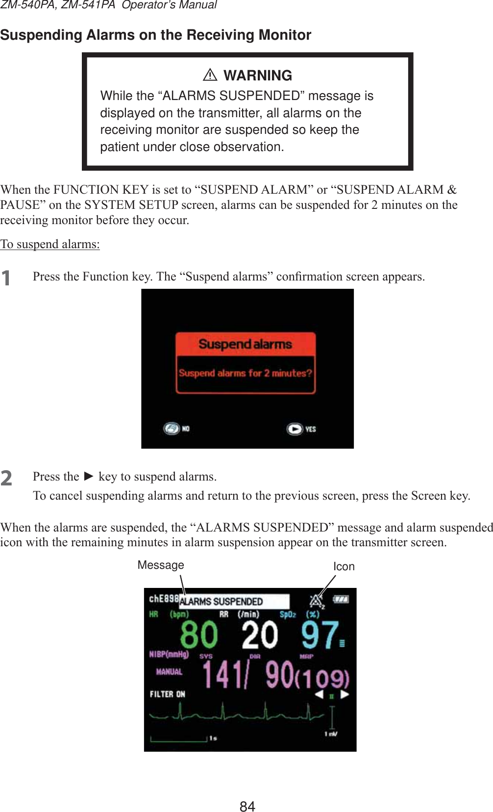 84ZM-540PA, ZM-541PA  Operator’s ManualSuspending Alarms on the Receiving MonitorWARNINGWhile the “ALARMS SUSPENDED” message is displayed on the transmitter, all alarms on the receiving monitor are suspended so keep the patient under close observation.:KHQWKH)81&amp;7,21.(&lt;LVVHWWR³6863(1&apos;$/$50´RU³6863(1&apos;$/$503$86(´RQWKH6&lt;67(06(783VFUHHQDODUPVFDQEHVXVSHQGHGIRUPLQXWHVRQWKHUHFHLYLQJPRQLWRUEHIRUHWKH\RFFXU7RVXVSHQGDODUPV1 3UHVVWKH)XQFWLRQNH\7KH³6XVSHQGDODUPV´FRQ¿UPDWLRQVFUHHQDSSHDUV2 3UHVVWKHŹNH\WRVXVSHQGDODUPV7RFDQFHOVXVSHQGLQJDODUPVDQGUHWXUQWRWKHSUHYLRXVVFUHHQSUHVVWKH6FUHHQNH\:KHQWKHDODUPVDUHVXVSHQGHGWKH³$/$5066863(1&apos;(&apos;´PHVVDJHDQGDODUPVXVSHQGHGLFRQZLWKWKHUHPDLQLQJPLQXWHVLQDODUPVXVSHQVLRQDSSHDURQWKHWUDQVPLWWHUVFUHHQMessage Icon