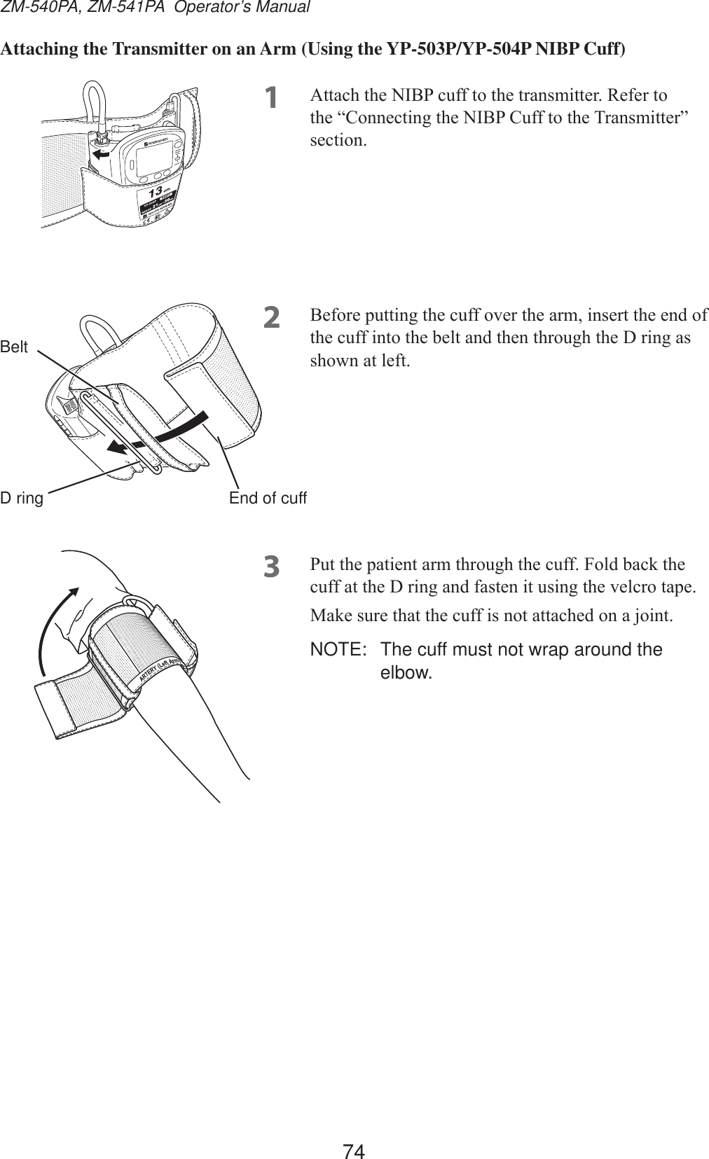 74ZM-540PA, ZM-541PA  Operator’s ManualAttaching the Transmitter on an Arm (Using the YP-503P/YP-504P NIBP Cuff)1 $WWDFKWKH1,%3FXIIWRWKHWUDQVPLWWHU5HIHUWRWKH³&amp;RQQHFWLQJWKH1,%3&amp;XIIWRWKH7UDQVPLWWHU´VHFWLRQ2 %HIRUHSXWWLQJWKHFXIIRYHUWKHDUPLQVHUWWKHHQGRIWKHFXIILQWRWKHEHOWDQGWKHQWKURXJKWKH&apos;ULQJDVVKRZQDWOHIW3 3XWWKHSDWLHQWDUPWKURXJKWKHFXII)ROGEDFNWKHFXIIDWWKH&apos;ULQJDQGIDVWHQLWXVLQJWKHYHOFURWDSH0DNHVXUHWKDWWKHFXIILVQRWDWWDFKHGRQDMRLQWNOTE:  The cuff must not wrap around the elbow.BeltD ring End of cuff