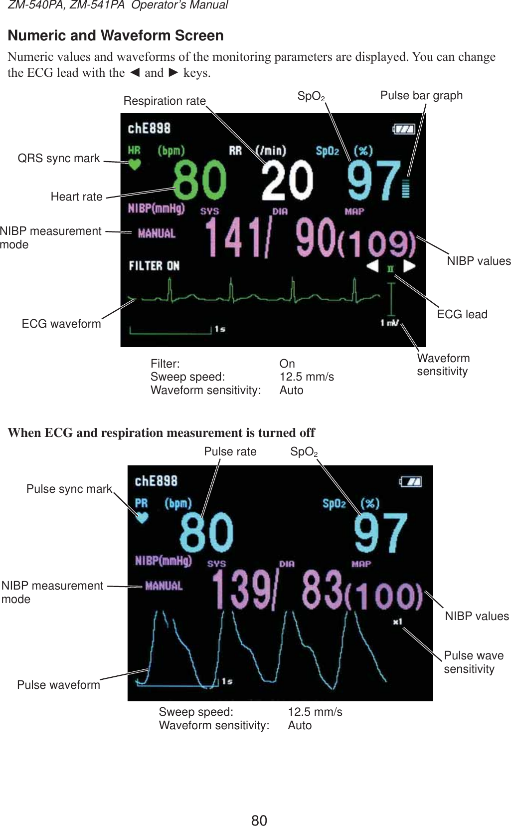 80ZM-540PA, ZM-541PA  Operator’s ManualNumeric and Waveform Screen1XPHULFYDOXHVDQGZDYHIRUPVRIWKHPRQLWRULQJSDUDPHWHUVDUHGLVSOD\HG&lt;RXFDQFKDQJHWKH(&amp;*OHDGZLWKWKHŻDQGŹNH\VHeart rateQRS sync markPulse bar graphSpO2Respiration rateNIBP valuesECG waveformFilter: OnSweep speed:  12.5 mm/sWaveform sensitivity:  AutoWaveform sensitivityECG leadNIBP measurement modeWhen ECG and respiration measurement is turned offPulse ratePulse sync markSpO2Pulse wave sensitivityPulse waveformSweep speed:  12.5 mm/sWaveform sensitivity:  AutoNIBP valuesNIBP measurement mode