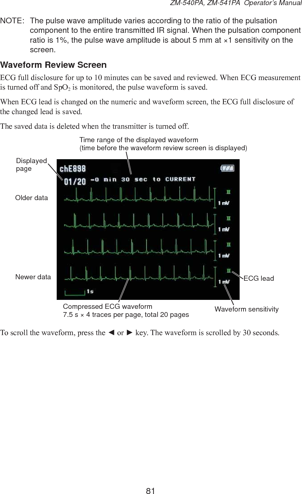 81ZM-540PA, ZM-541PA  Operator’s ManualNOTE:  The pulse wave amplitude varies according to the ratio of the pulsation component to the entire transmitted IR signal. When the pulsation component ratio is 1%, the pulse wave amplitude is about 5 mm at ×1 sensitivity on the screen.Waveform Review Screen(&amp;*IXOOGLVFORVXUHIRUXSWRPLQXWHVFDQEHVDYHGDQGUHYLHZHG:KHQ(&amp;*PHDVXUHPHQWLVWXUQHGRIIDQG6S22LVPRQLWRUHGWKHSXOVHZDYHIRUPLVVDYHG:KHQ(&amp;*OHDGLVFKDQJHGRQWKHQXPHULFDQGZDYHIRUPVFUHHQWKH(&amp;*IXOOGLVFORVXUHRIWKHFKDQJHGOHDGLVVDYHG7KHVDYHGGDWDLVGHOHWHGZKHQWKHWUDQVPLWWHULVWXUQHGRIIECG leadDisplayed pageCompressed ECG waveform7.5 s × 4 traces per page, total 20 pagesOlder dataNewer dataTime range of the displayed waveform (time before the waveform review screen is displayed)Waveform sensitivity7RVFUROOWKHZDYHIRUPSUHVVWKHŻRUŹNH\7KHZDYHIRUPLVVFUROOHGE\VHFRQGV