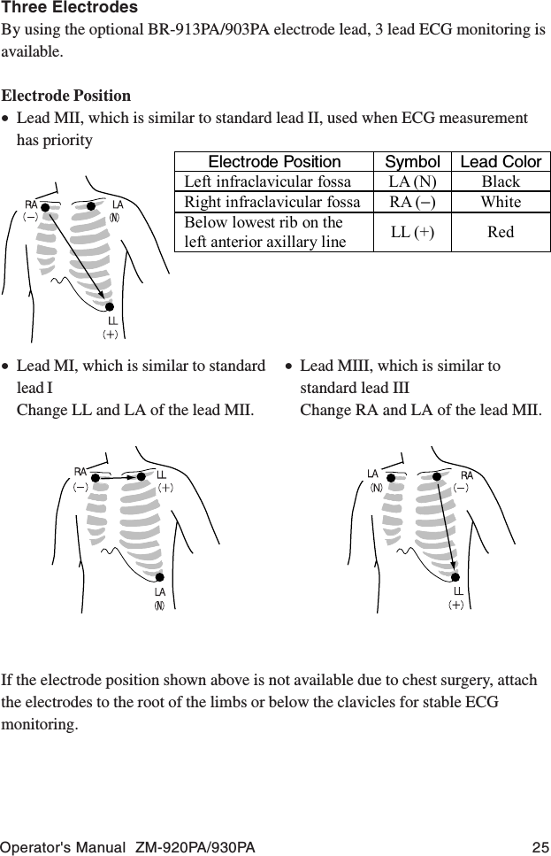 Operator&apos;s Manual  ZM-920PA/930PA 25If the electrode position shown above is not available due to chest surgery, attachthe electrodes to the root of the limbs or below the clavicles for stable ECGmonitoring.Three ElectrodesBy using the optional BR-913PA/903PA electrode lead, 3 lead ECG monitoring isavailable.Electrode Position•Lead MII, which is similar to standard lead II, used when ECG measurementhas priority•Lead MI, which is similar to standardlead IChange LL and LA of the lead MII.•Lead MIII, which is similar tostandard lead IIIChange RA and LA of the lead MII.Electrode Position  Symbol  Lead Color Left infraclavicular fossa  LA (N)  Black Right infraclavicular fossa  RA (−)  White Below lowest rib on the left anterior axillary line  LL (+)  Red  