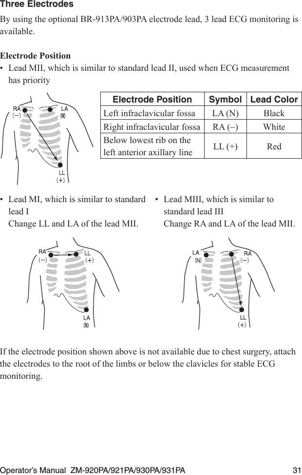 Operator’s Manual  ZM-920PA/921PA/930PA/931PA  31Three ElectrodesBy using the optional BR-913PA/903PA electrode lead, 3 lead ECG monitoring is available.Electrode Position•  Lead MII, which is similar to standard lead II, used when ECG measurement has priorityElectrode Position Symbol Lead ColorLeft infraclavicular fossa LA (N) BlackRight infraclavicular fossa RA (−)WhiteBelow lowest rib on the left anterior axillary line LL (+) Red•  Lead MI, which is similar to standard lead I  Change LL and LA of the lead MII.•  Lead MIII, which is similar to standard lead III  Change RA and LA of the lead MII.If the electrode position shown above is not available due to chest surgery, attach the electrodes to the root of the limbs or below the clavicles for stable ECG monitoring.