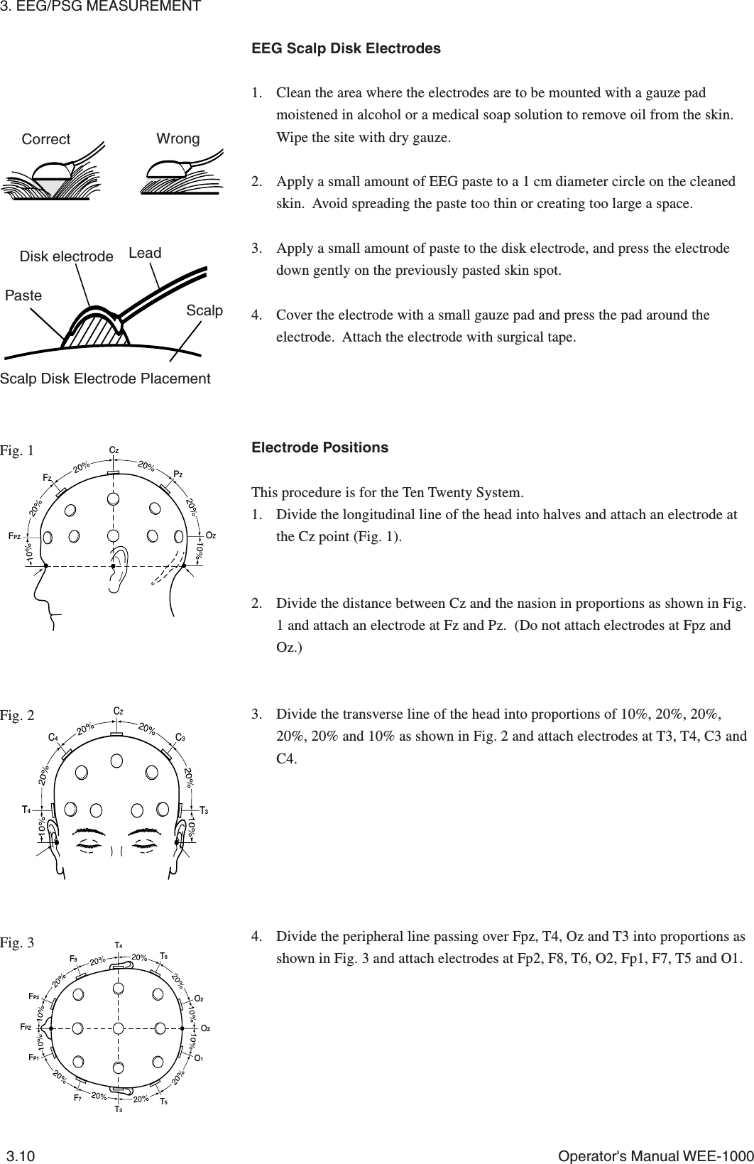 3. EEG/PSG MEASUREMENT3.10 Operator&apos;s Manual WEE-1000EEG Scalp Disk Electrodes1. Clean the area where the electrodes are to be mounted with a gauze padmoistened in alcohol or a medical soap solution to remove oil from the skin.Wipe the site with dry gauze.2. Apply a small amount of EEG paste to a 1 cm diameter circle on the cleanedskin.  Avoid spreading the paste too thin or creating too large a space.3. Apply a small amount of paste to the disk electrode, and press the electrodedown gently on the previously pasted skin spot.4. Cover the electrode with a small gauze pad and press the pad around theelectrode.  Attach the electrode with surgical tape.Electrode PositionsThis procedure is for the Ten Twenty System.1. Divide the longitudinal line of the head into halves and attach an electrode atthe Cz point (Fig. 1).2. Divide the distance between Cz and the nasion in proportions as shown in Fig.1 and attach an electrode at Fz and Pz.  (Do not attach electrodes at Fpz andOz.)3. Divide the transverse line of the head into proportions of 10%, 20%, 20%,20%, 20% and 10% as shown in Fig. 2 and attach electrodes at T3, T4, C3 andC4.4. Divide the peripheral line passing over Fpz, T4, Oz and T3 into proportions asshown in Fig. 3 and attach electrodes at Fp2, F8, T6, O2, Fp1, F7, T5 and O1.Fig. 1Fig. 2Fig. 3CZFZFPZPZOZT3T4C3CZC4FP2FP1FPZF8T4T3T5O1O2OZT6F7Disk electrode LeadPasteScalpScalp Disk Electrode PlacementCorrect Wrong