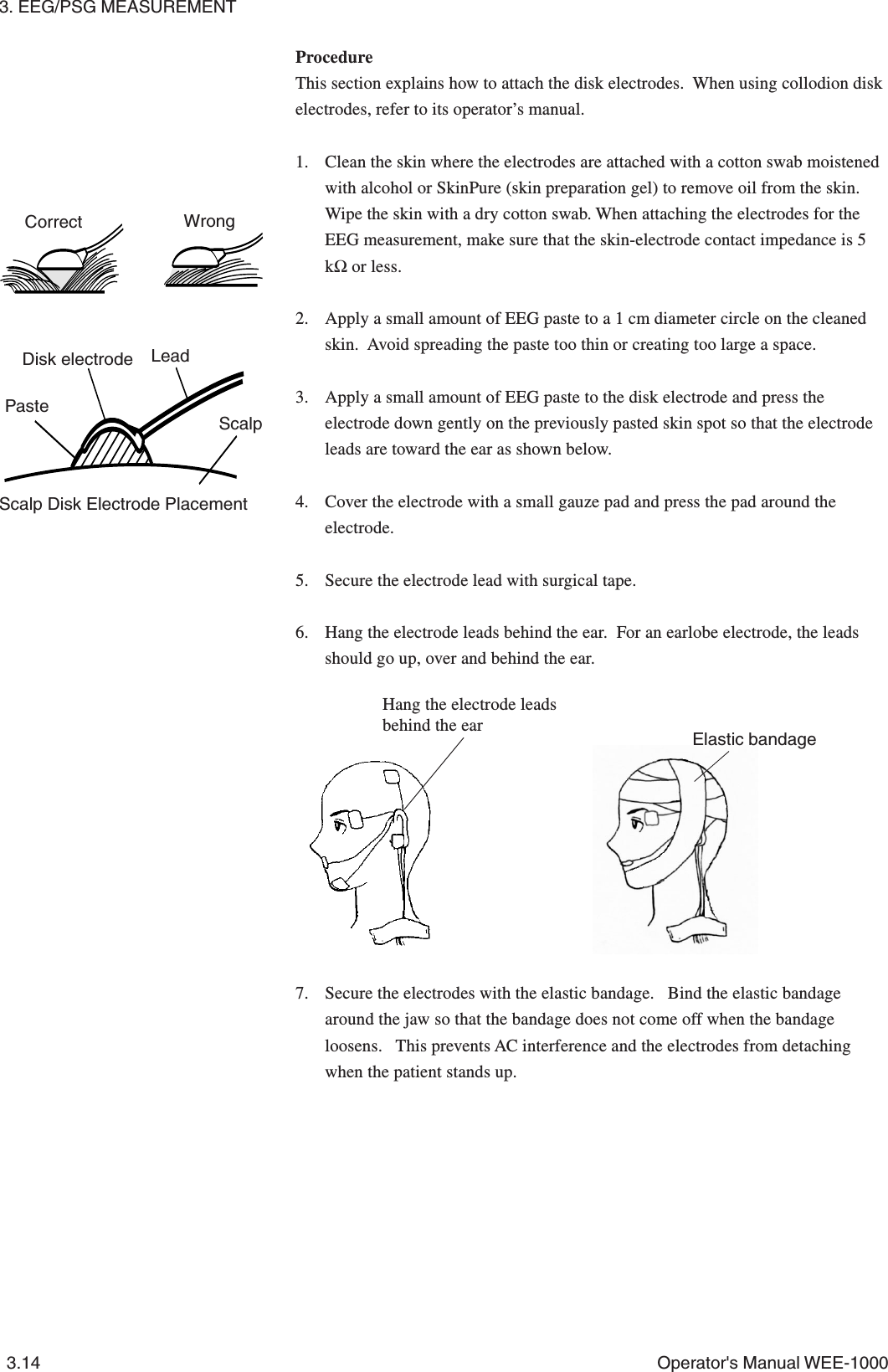 3. EEG/PSG MEASUREMENT3.14 Operator&apos;s Manual WEE-1000ProcedureThis section explains how to attach the disk electrodes.  When using collodion diskelectrodes, refer to its operator’s manual.1. Clean the skin where the electrodes are attached with a cotton swab moistenedwith alcohol or SkinPure (skin preparation gel) to remove oil from the skin.Wipe the skin with a dry cotton swab. When attaching the electrodes for theEEG measurement, make sure that the skin-electrode contact impedance is 5kΩ or less.2. Apply a small amount of EEG paste to a 1 cm diameter circle on the cleanedskin.  Avoid spreading the paste too thin or creating too large a space.3. Apply a small amount of EEG paste to the disk electrode and press theelectrode down gently on the previously pasted skin spot so that the electrodeleads are toward the ear as shown below.4. Cover the electrode with a small gauze pad and press the pad around theelectrode.5. Secure the electrode lead with surgical tape.6. Hang the electrode leads behind the ear.  For an earlobe electrode, the leadsshould go up, over and behind the ear.Disk electrode LeadPasteScalpScalp Disk Electrode PlacementCorrect Wrong7. Secure the electrodes with the elastic bandage.   Bind the elastic bandagearound the jaw so that the bandage does not come off when the bandageloosens.   This prevents AC interference and the electrodes from detachingwhen the patient stands up.Hang the electrode leadsbehind the ear Elastic bandage