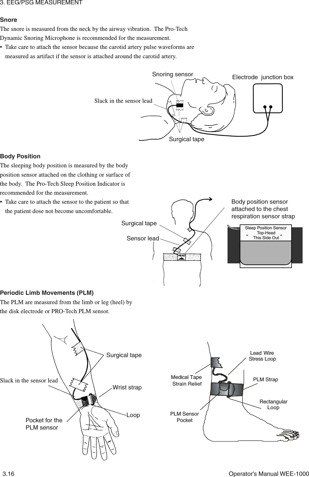 3. EEG/PSG MEASUREMENT3.16 Operator&apos;s Manual WEE-1000Surgical tapeWrist strapLoopSlack in the sensor leadPocket for thePLM sensorPeriodic Limb Movements (PLM)The PLM are measured from the limb or leg (heel) bythe disk electrode or PRO-Tech PLM sensor.Body PositionThe sleeping body position is measured by the bodyposition sensor attached on the clothing or surface ofthe body.  The Pro-Tech Sleep Position Indicator isrecommended for the measurement.• Take care to attach the sensor to the patient so thatthe patient dose not become uncomfortable.Sleep Position SensorTop-HeadThis Side Out--Surgical tapeSensor leadBody position sensorattached to the chestrespiration sensor strapSnoreThe snore is measured from the neck by the airway vibration.  The Pro-TechDynamic Snoring Microphone is recommended for the measurement.• Take care to attach the sensor because the carotid artery pulse waveforms aremeasured as artifact if the sensor is attached around the carotid artery.Surgical tapeSnoring sensorSlack in the sensor leadElectrode  junction boxPLM Sensor PocketPLM StrapLead WireStress LoopMedical Tape Strain ReliefRectangularLoop  