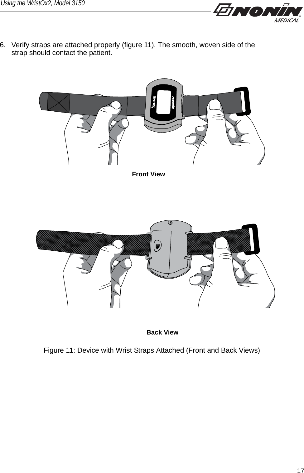 17Using the WristOx2, Model 31506. Verify straps are attached properly (figure 11). The smooth, woven side of the strap should contact the patient.Front ViewBack View Figure 11: Device with Wrist Straps Attached (Front and Back Views)