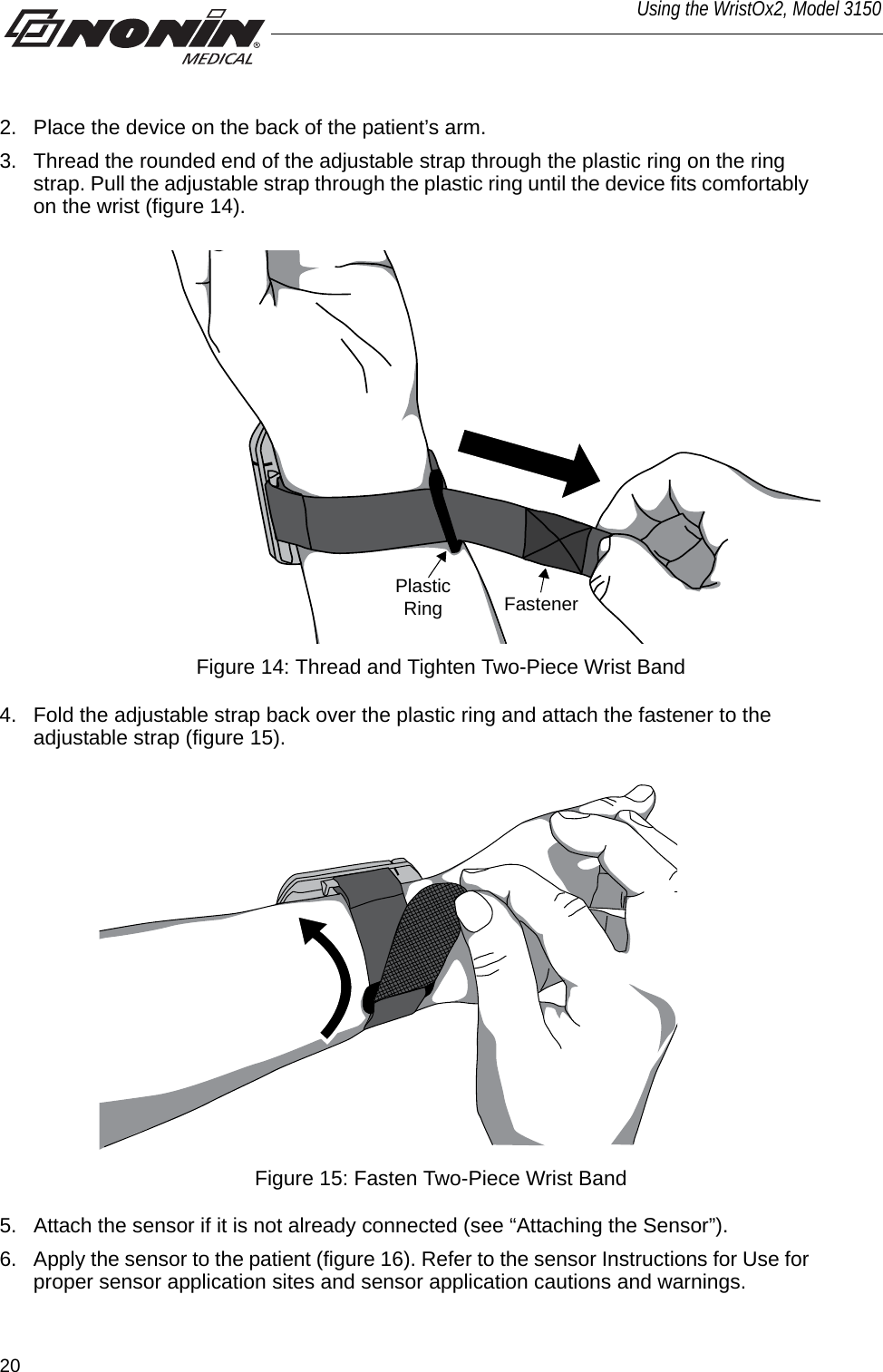 20Using the WristOx2, Model 31502. Place the device on the back of the patient’s arm. 3. Thread the rounded end of the adjustable strap through the plastic ring on the ring strap. Pull the adjustable strap through the plastic ring until the device fits comfortably on the wrist (figure 14). FastenerPlastic RingFigure 14: Thread and Tighten Two-Piece Wrist Band4. Fold the adjustable strap back over the plastic ring and attach the fastener to the adjustable strap (figure 15). Figure 15: Fasten Two-Piece Wrist Band5. Attach the sensor if it is not already connected (see “Attaching the Sensor”).6. Apply the sensor to the patient (figure 16). Refer to the sensor Instructions for Use for proper sensor application sites and sensor application cautions and warnings. 