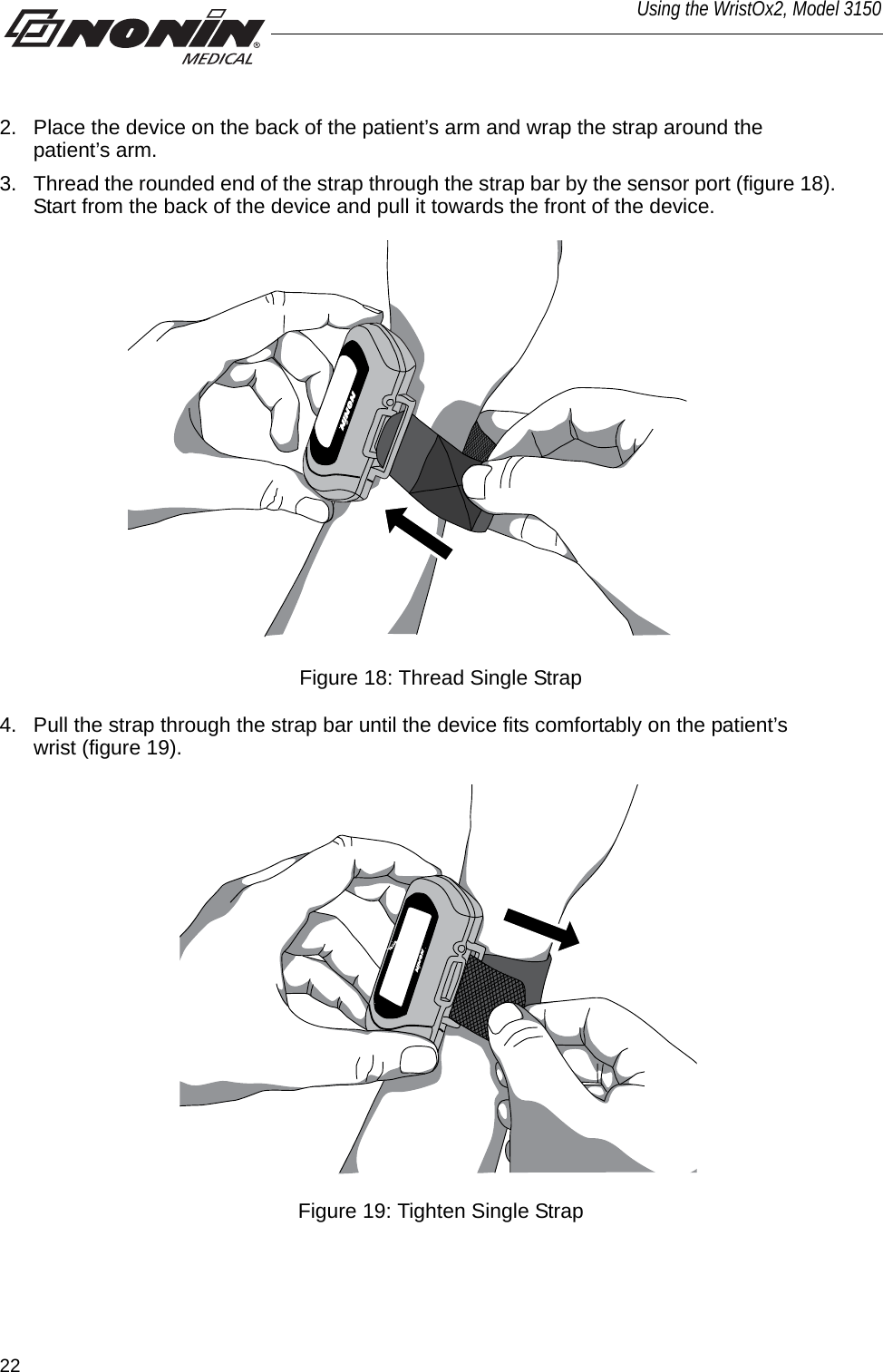 22Using the WristOx2, Model 31502. Place the device on the back of the patient’s arm and wrap the strap around the patient’s arm. 3. Thread the rounded end of the strap through the strap bar by the sensor port (figure 18). Start from the back of the device and pull it towards the front of the device.Figure 18: Thread Single Strap4. Pull the strap through the strap bar until the device fits comfortably on the patient’s wrist (figure 19). Figure 19: Tighten Single Strap