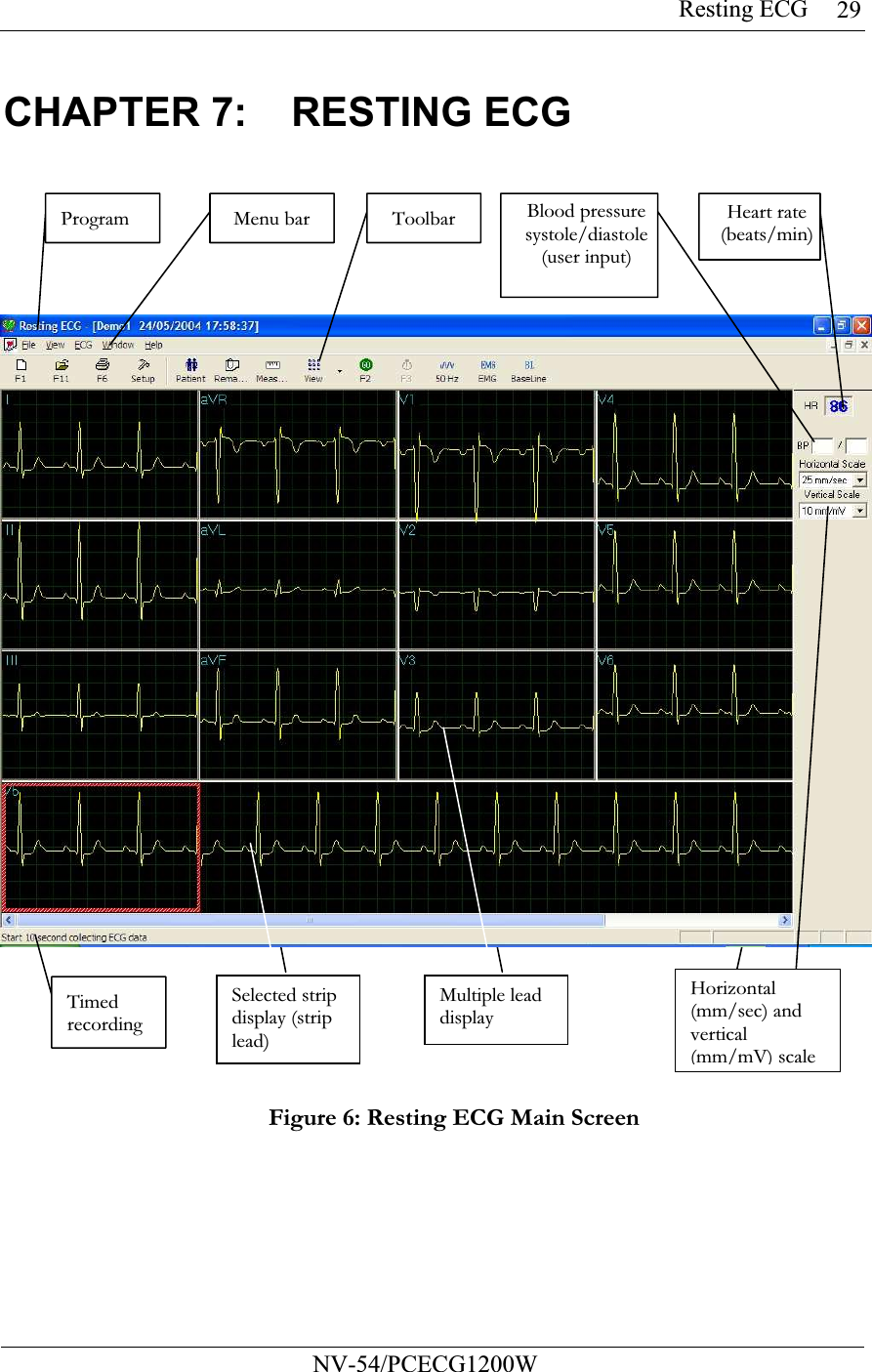 Resting ECG           NV-54/PCECG1200W 29CHAPTER 7:  RESTING ECG   Figure 6: Resting ECG Main Screen Program  Menu bar Toolbar Blood pressure systole/diastole  (user input) Heart rate (beats/min)Timed recording Selected strip display (strip lead) Multiple lead display Horizontal (mm/sec) and vertical (mm/mV) scale