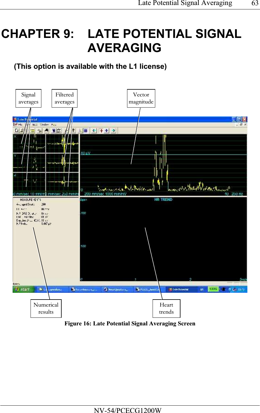 Late Potential Signal Averaging           NV-54/PCECG1200W 63CHAPTER 9:  LATE POTENTIAL SIGNAL AVERAGING (This option is available with the L1 license)   Figure 16: Late Potential Signal Averaging Screen Signal averagesFiltered averagesVector magnitudeNumerical results Heart trends 