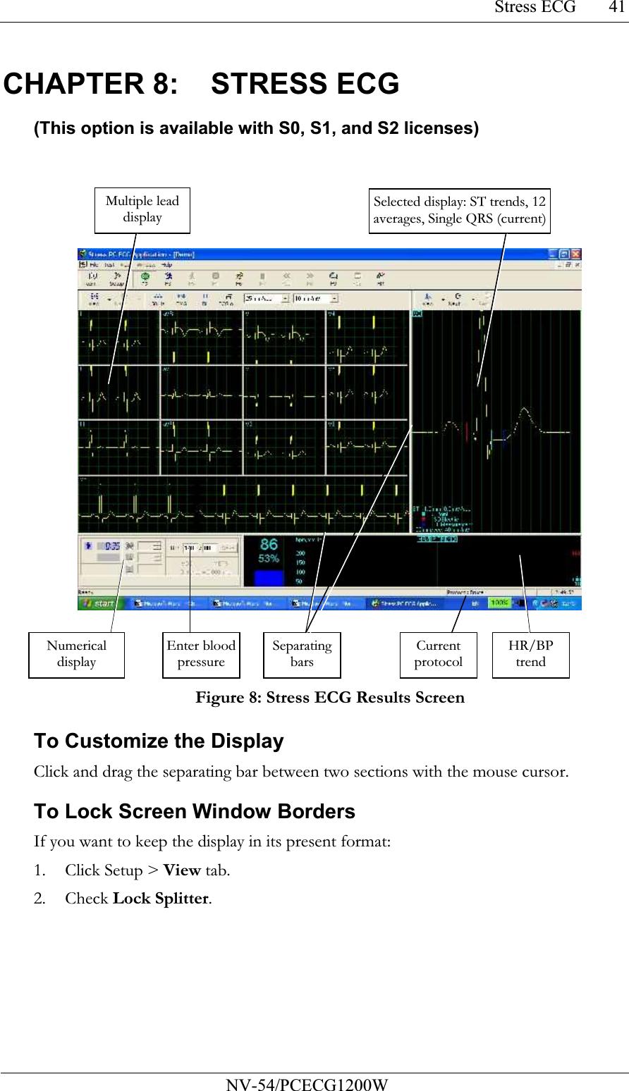 Stress ECG           NV-54/PCECG1200W 41CHAPTER 8:  STRESS ECG (This option is available with S0, S1, and S2 licenses)   Figure 8: Stress ECG Results Screen To Customize the Display Click and drag the separating bar between two sections with the mouse cursor. To Lock Screen Window Borders If you want to keep the display in its present format: 1. Click Setup &gt; View tab. 2. Check Lock Splitter. Multiple lead display Selected display: ST trends, 12 averages, Single QRS (current)Numerical display HR/BP trend Separating bars Current protocol Enter blood pressure 