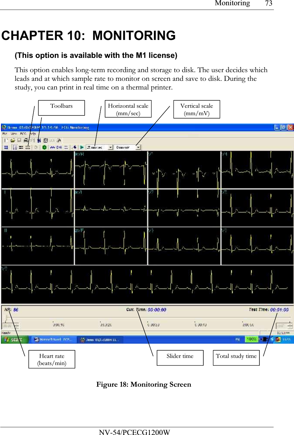 Monitoring           NV-54/PCECG1200W 73CHAPTER 10:  MONITORING (This option is available with the M1 license) This option enables long-term recording and storage to disk. The user decides which leads and at which sample rate to monitor on screen and save to disk. During the study, you can print in real time on a thermal printer.  Figure 18: Monitoring Screen Horizontal scale (mm/sec) Vertical scale (mm/mV) Toolbars Heart rate (beats/min) Slider time Total study time