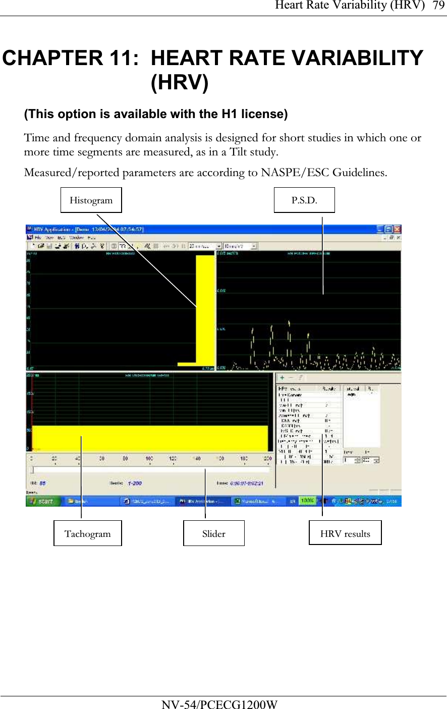 Heart Rate Variability (HRV)          NV-54/PCECG1200W 79CHAPTER 11:  HEART RATE VARIABILITY (HRV) (This option is available with the H1 license) Time and frequency domain analysis is designed for short studies in which one or more time segments are measured, as in a Tilt study. Measured/reported parameters are according to NASPE/ESC Guidelines.  Histogram P.S.D. Tachogram Slider HRV results 