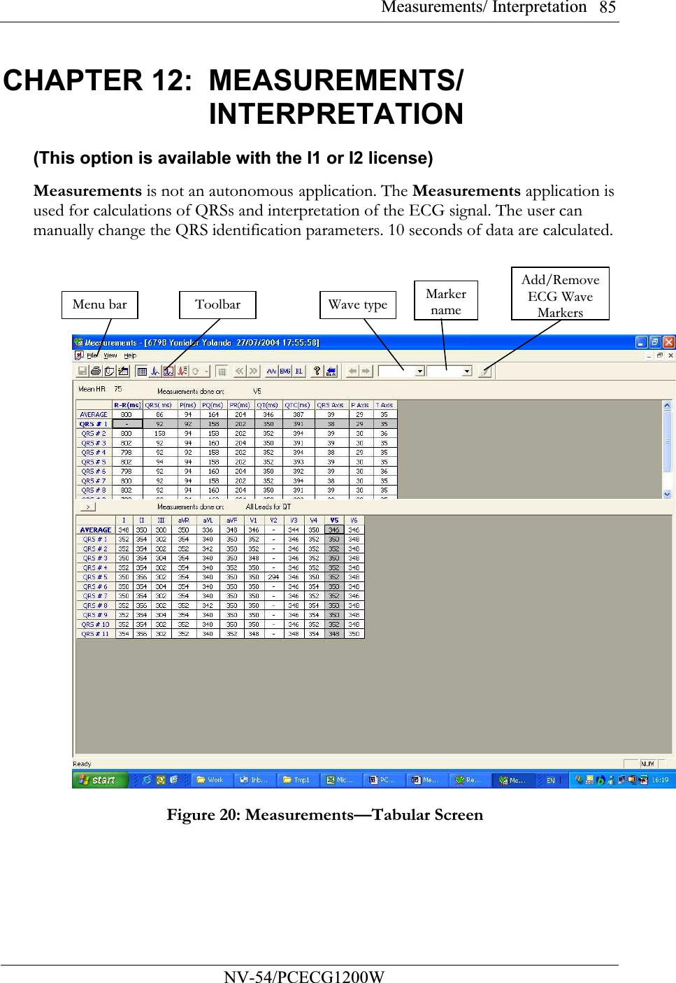 Measurements/ Interpretation          NV-54/PCECG1200W 85CHAPTER 12:  MEASUREMENTS/ INTERPRETATION (This option is available with the I1 or I2 license) Measurements is not an autonomous application. The Measurements application is used for calculations of QRSs and interpretation of the ECG signal. The user can manually change the QRS identification parameters. 10 seconds of data are calculated.  Figure 20: Measurements—Tabular Screen Menu bar Toolbar  Wave type Marker name Add/Remove ECG Wave Markers