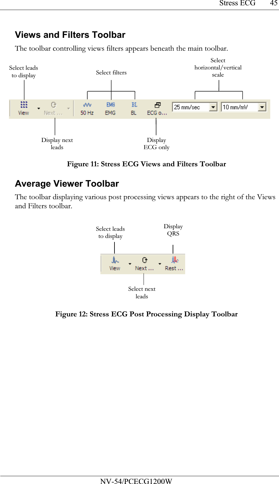 Stress ECG           NV-54/PCECG1200W 45Views and Filters Toolbar The toolbar controlling views filters appears beneath the main toolbar.  Figure 11: Stress ECG Views and Filters Toolbar Average Viewer Toolbar The toolbar displaying various post processing views appears to the right of the Views and Filters toolbar.   Figure 12: Stress ECG Post Processing Display Toolbar Select leads to display Select filters Select horizontal/vertical scale Display next leads Display ECG only Select leads to display Select next leads Display QRS 