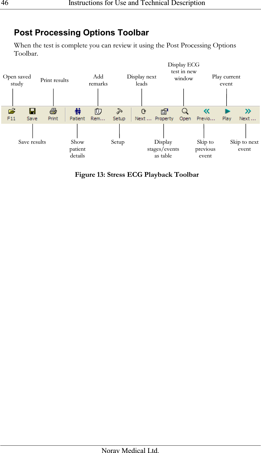  Instructions for Use and Technical Description  Norav Medical Ltd. 46Post Processing Options Toolbar When the test is complete you can review it using the Post Processing Options Toolbar.  Figure 13: Stress ECG Playback Toolbar Open saved study Print results Add remarks Display next leads Display ECG test in new window Play current event Save results Show patient details Setup Display stages/events as table Skip to previous event Skip to next event 