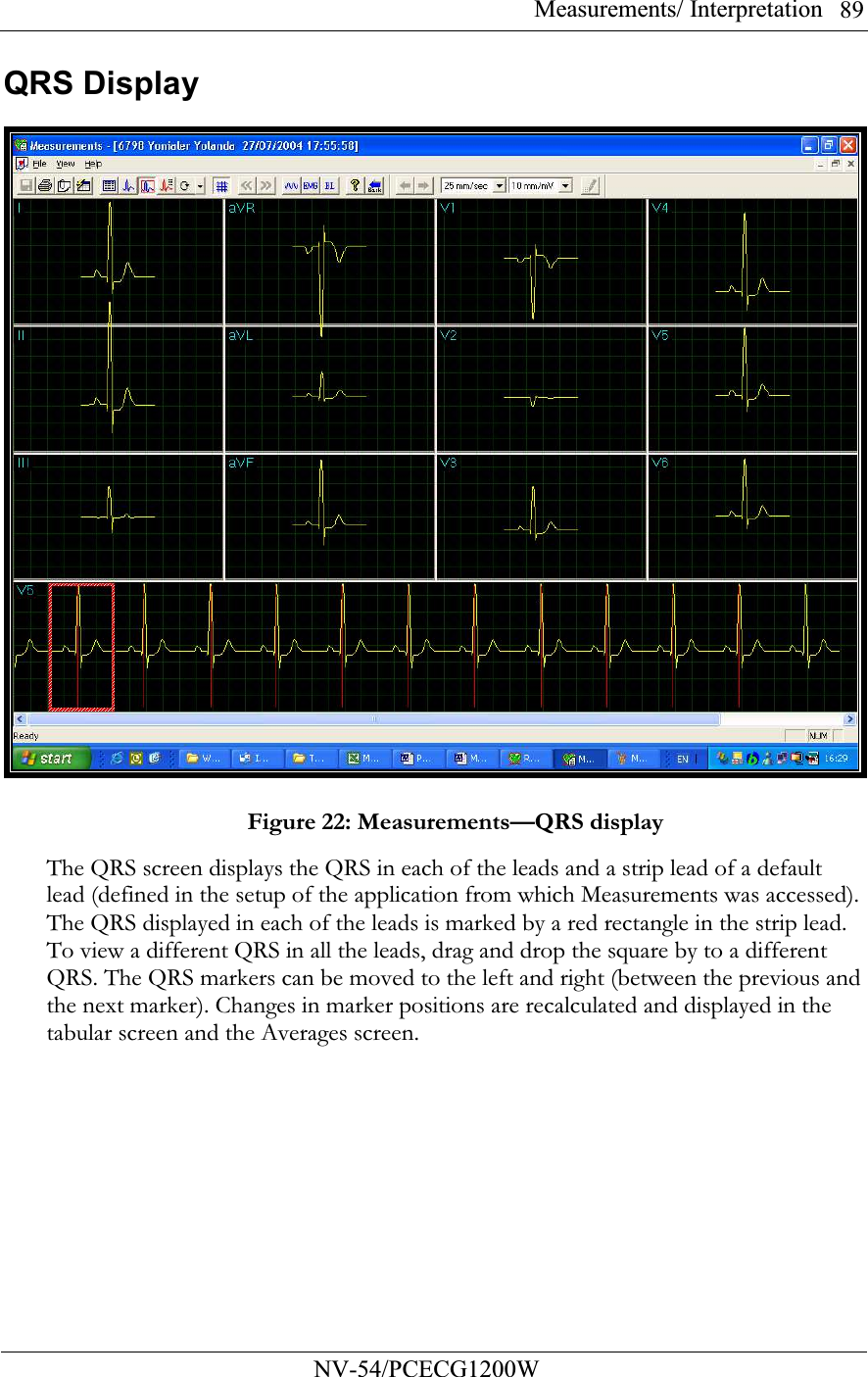 Measurements/ Interpretation          NV-54/PCECG1200W 89QRS Display    Figure 22: Measurements—QRS display The QRS screen displays the QRS in each of the leads and a strip lead of a default lead (defined in the setup of the application from which Measurements was accessed). The QRS displayed in each of the leads is marked by a red rectangle in the strip lead. To view a different QRS in all the leads, drag and drop the square by to a different QRS. The QRS markers can be moved to the left and right (between the previous and the next marker). Changes in marker positions are recalculated and displayed in the tabular screen and the Averages screen. 