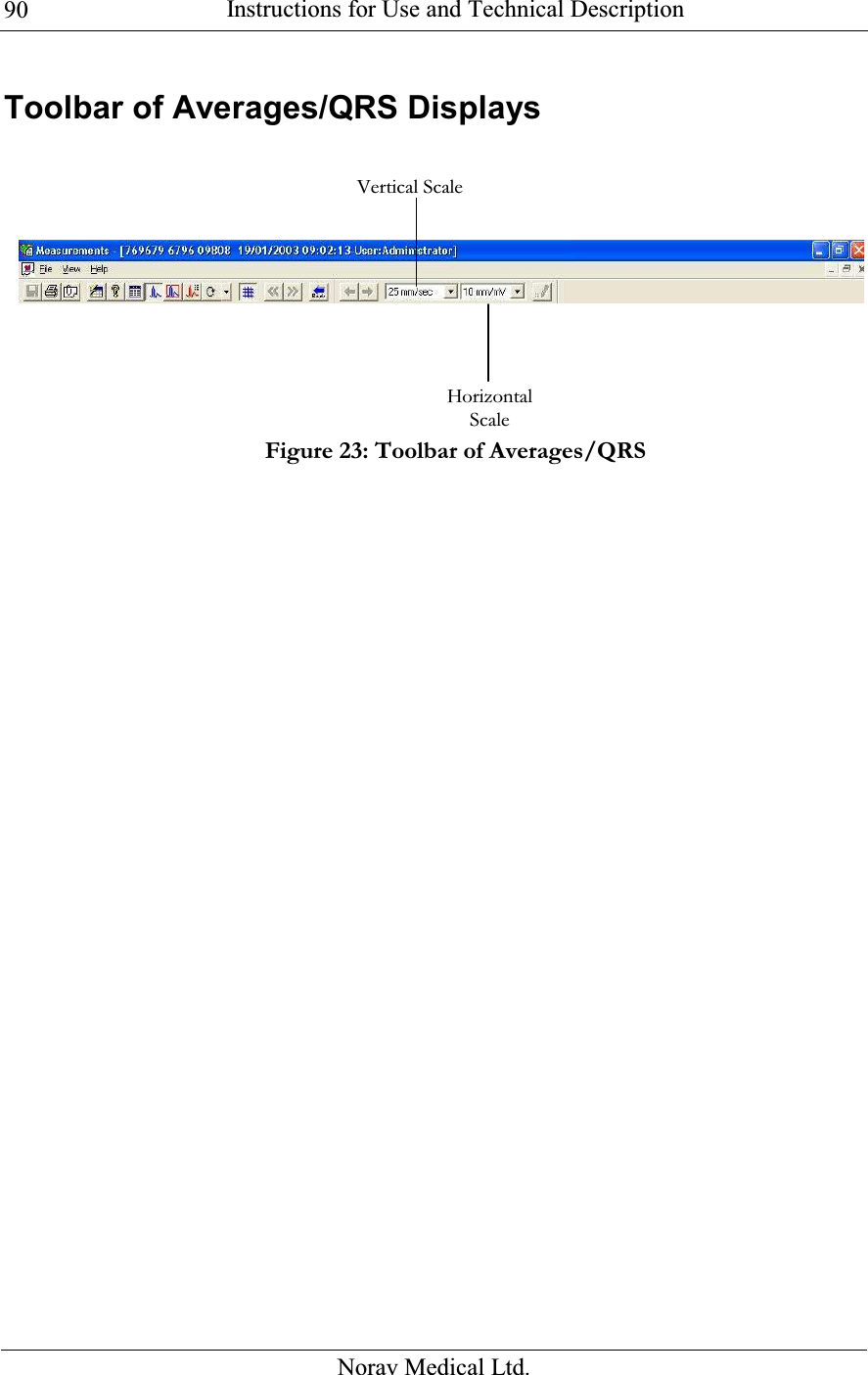  Instructions for Use and Technical Description  Norav Medical Ltd. 90Toolbar of Averages/QRS Displays  Figure 23: Toolbar of Averages/QRS Horizontal ScaleVertical Scale 