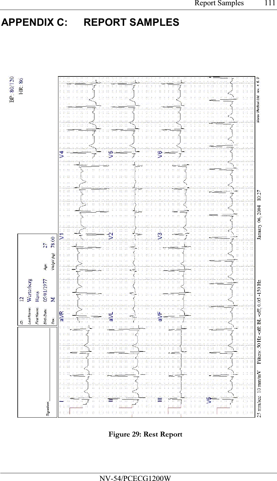 Report Samples           NV-54/PCECG1200W 111APPENDIX C:  REPORT SAMPLES   Figure 29: Rest Report  