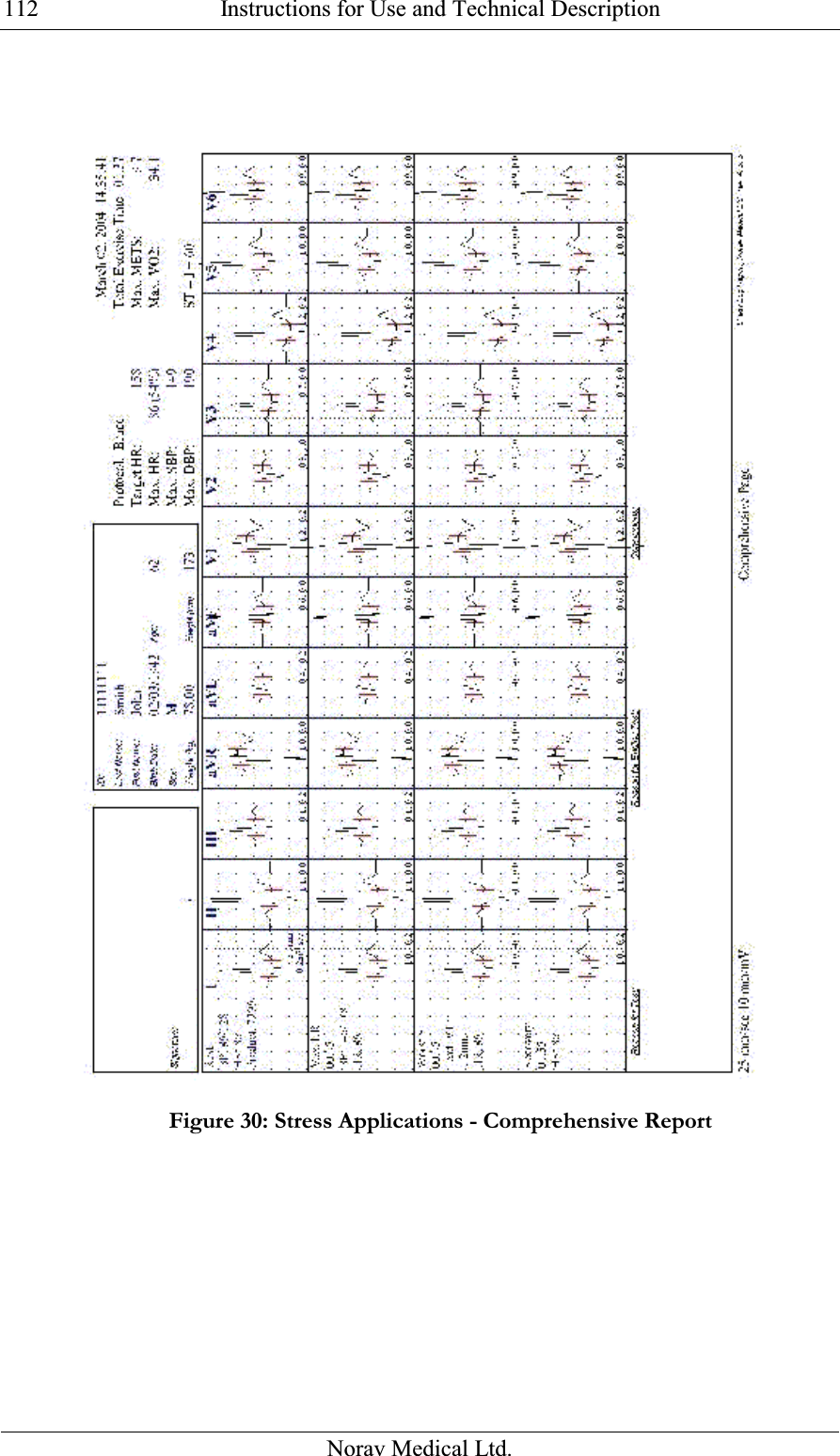  Instructions for Use and Technical Description  Norav Medical Ltd. 112 Figure 30: Stress Applications - Comprehensive Report  