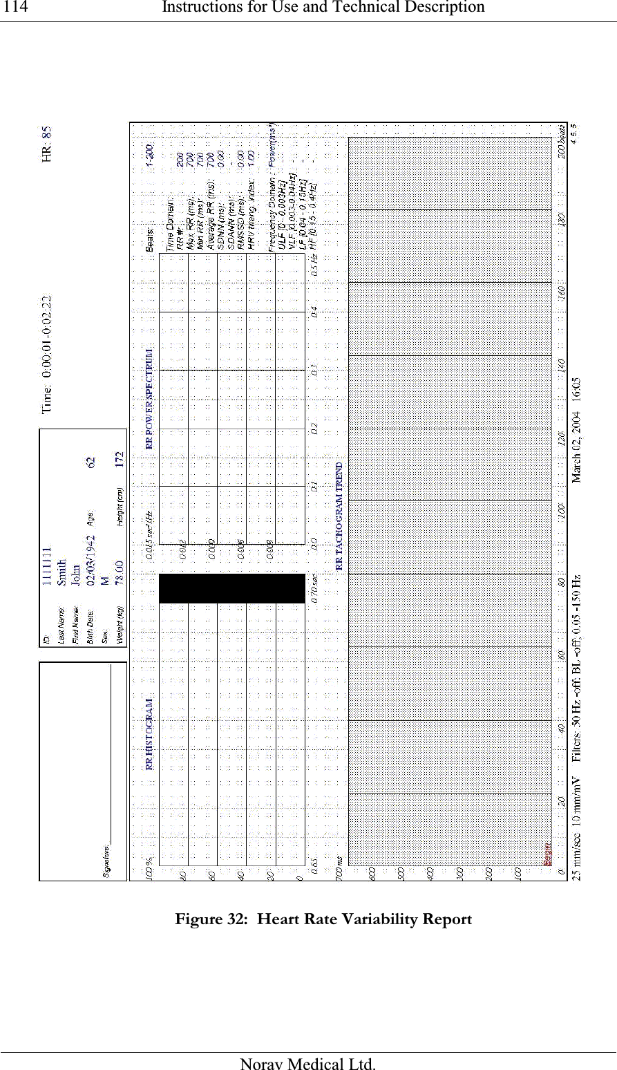  Instructions for Use and Technical Description  Norav Medical Ltd. 114 Figure 32:  Heart Rate Variability Report  