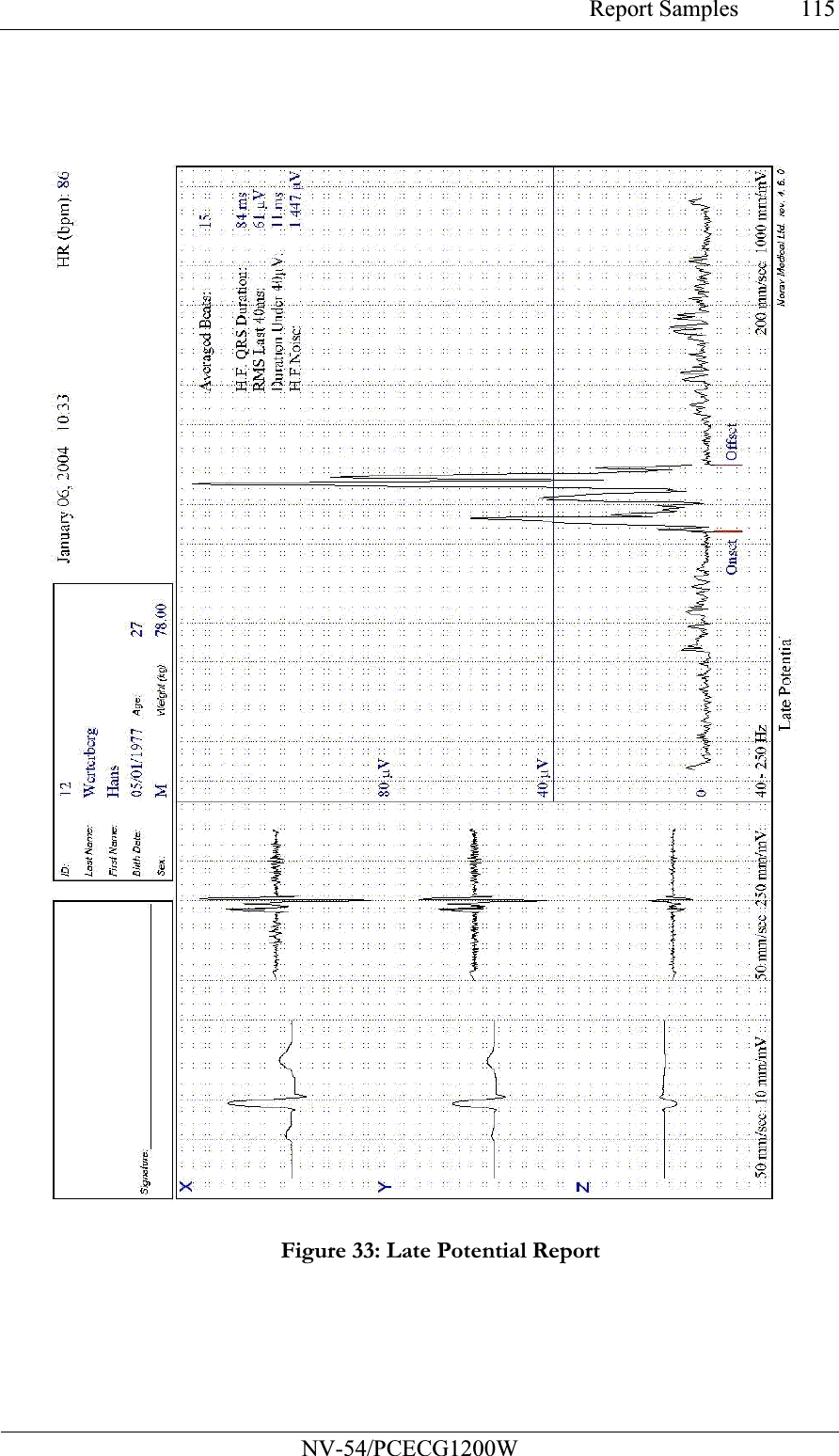 Report Samples           NV-54/PCECG1200W 115 Figure 33: Late Potential Report  