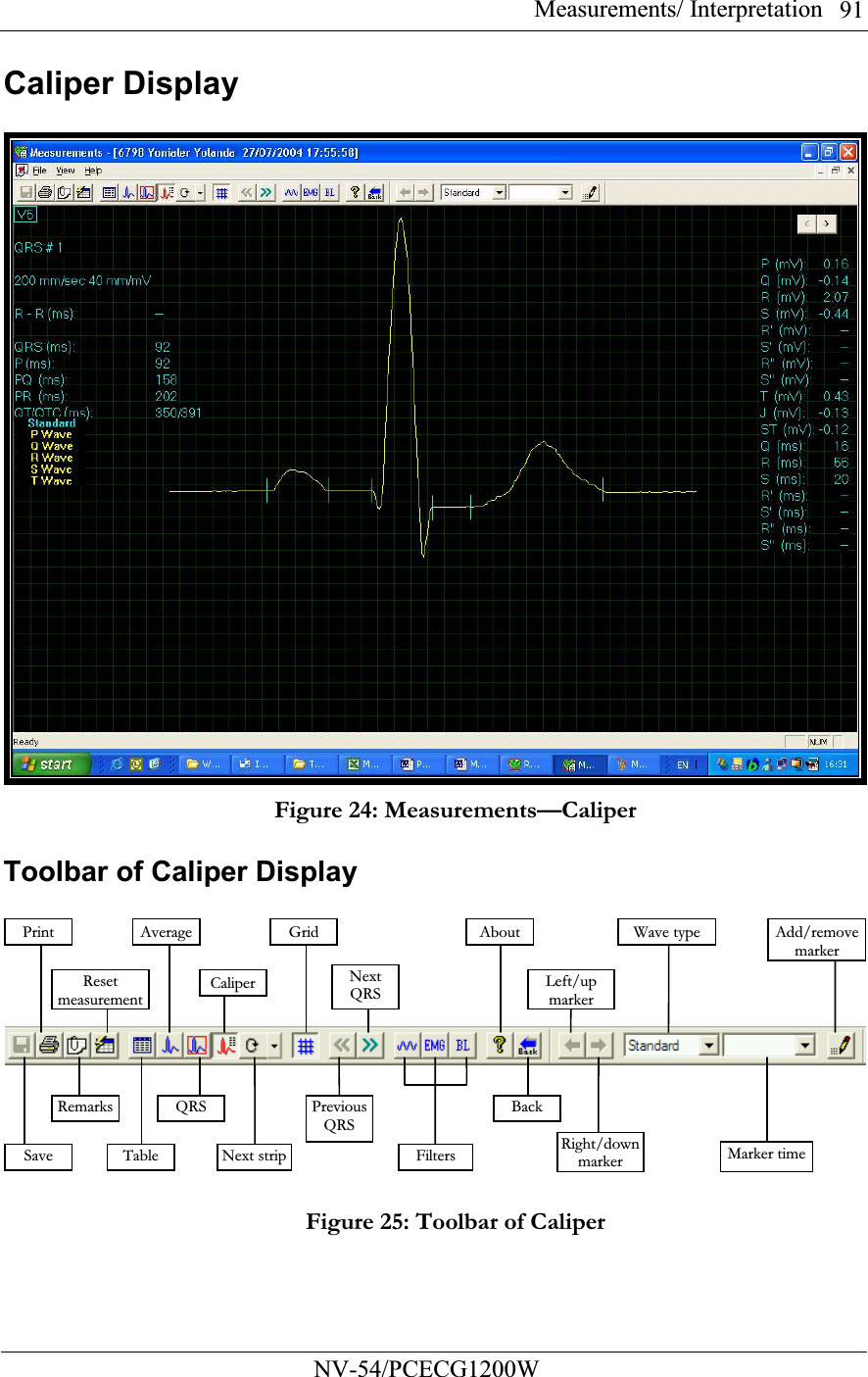 Measurements/ Interpretation          NV-54/PCECG1200W 91Caliper Display   Figure 24: Measurements—Caliper  Toolbar of Caliper Display    Figure 25: Toolbar of Caliper Print AverageSave  Table Reset measurementCaliper Grid Next QRS About  Add/remove markerRight/down markerRemarksQRS Next stripPreviousQRS Filters Back Left/up markerWave type Marker time