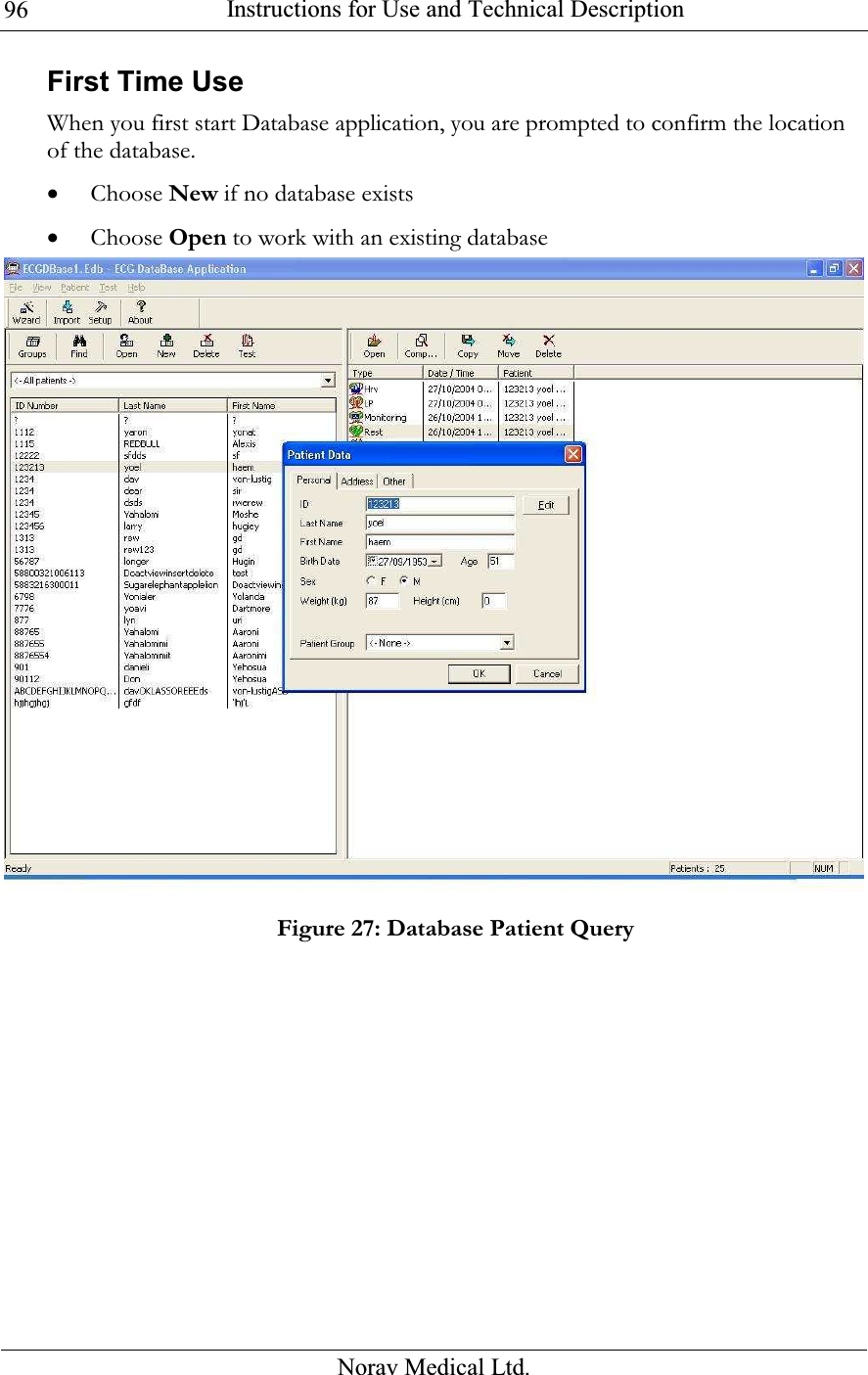  Instructions for Use and Technical Description  Norav Medical Ltd. 96First Time Use When you first start Database application, you are prompted to confirm the location of the database.  • Choose New if no database exists • Choose Open to work with an existing database  Figure 27: Database Patient Query   