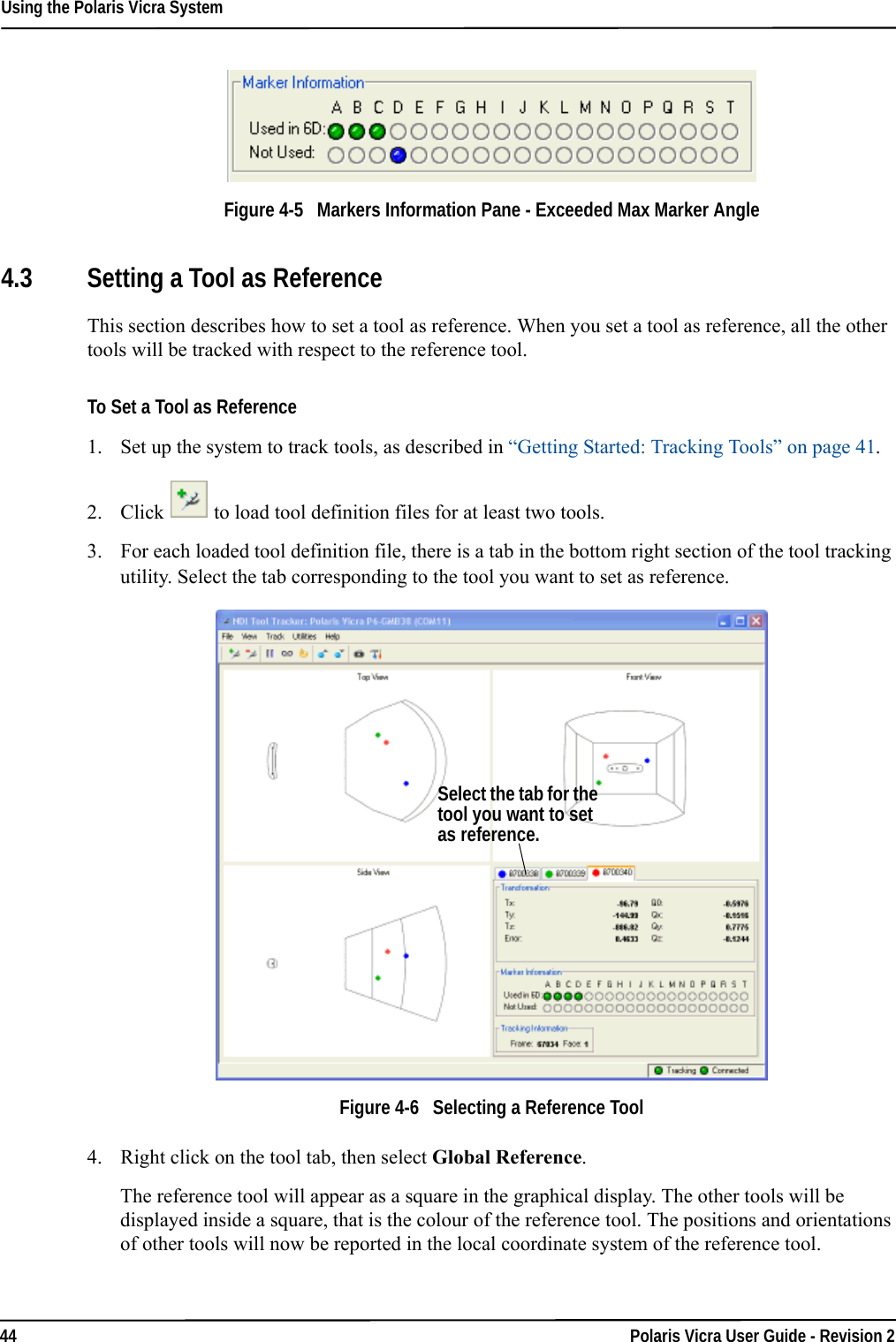 Using the Polaris Vicra System44 Polaris Vicra User Guide - Revision 2Figure 4-5   Markers Information Pane - Exceeded Max Marker Angle4.3 Setting a Tool as ReferenceThis section describes how to set a tool as reference. When you set a tool as reference, all the other tools will be tracked with respect to the reference tool.To Set a Tool as Reference1. Set up the system to track tools, as described in “Getting Started: Tracking Tools” on page 41.2. Click  to load tool definition files for at least two tools.3. For each loaded tool definition file, there is a tab in the bottom right section of the tool tracking utility. Select the tab corresponding to the tool you want to set as reference.Figure 4-6   Selecting a Reference Tool4. Right click on the tool tab, then select Global Reference.The reference tool will appear as a square in the graphical display. The other tools will be displayed inside a square, that is the colour of the reference tool. The positions and orientations of other tools will now be reported in the local coordinate system of the reference tool.Select the tab for the tool you want to set as reference.