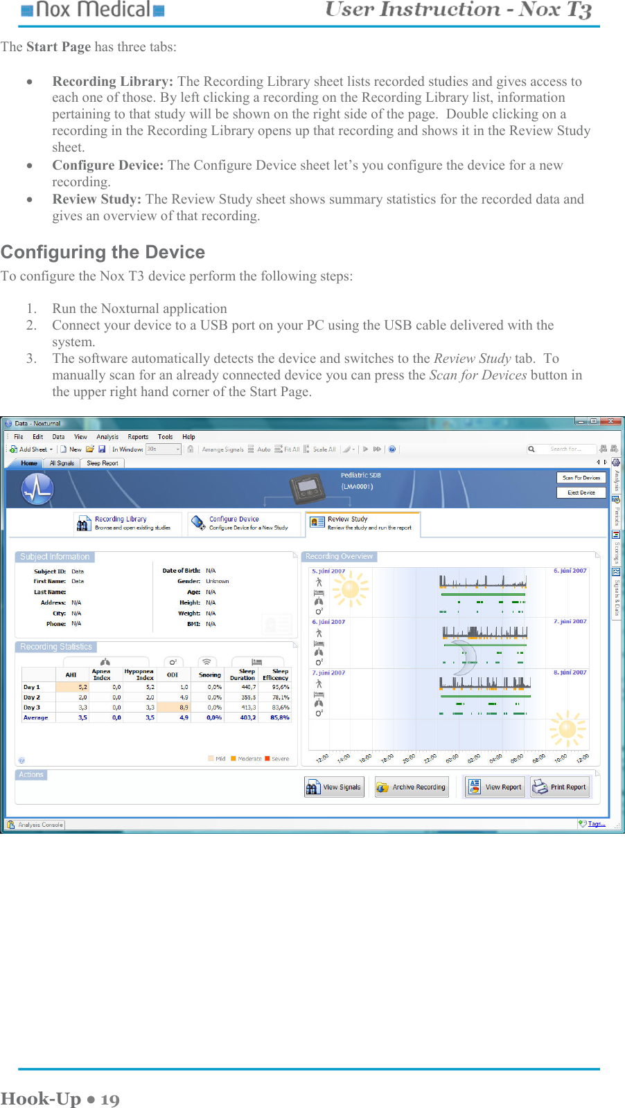    Hook-Up ● 19 The Start Page has three tabs:   • Recording Library: The Recording Library sheet lists recorded studies and gives access to each one of those. By left clicking a recording on the Recording Library list, information pertaining to that study will be shown on the right side of the page.  Double clicking on a recording in the Recording Library opens up that recording and shows it in the Review Study sheet. • Configure Device: The Configure Device sheet let’s you configure the device for a new recording. • Review Study: The Review Study sheet shows summary statistics for the recorded data and gives an overview of that recording. Configuring the Device To configure the Nox T3 device perform the following steps:  1. Run the Noxturnal application 2. Connect your device to a USB port on your PC using the USB cable delivered with the system. 3. The software automatically detects the device and switches to the Review Study tab.  To manually scan for an already connected device you can press the Scan for Devices button in the upper right hand corner of the Start Page.        