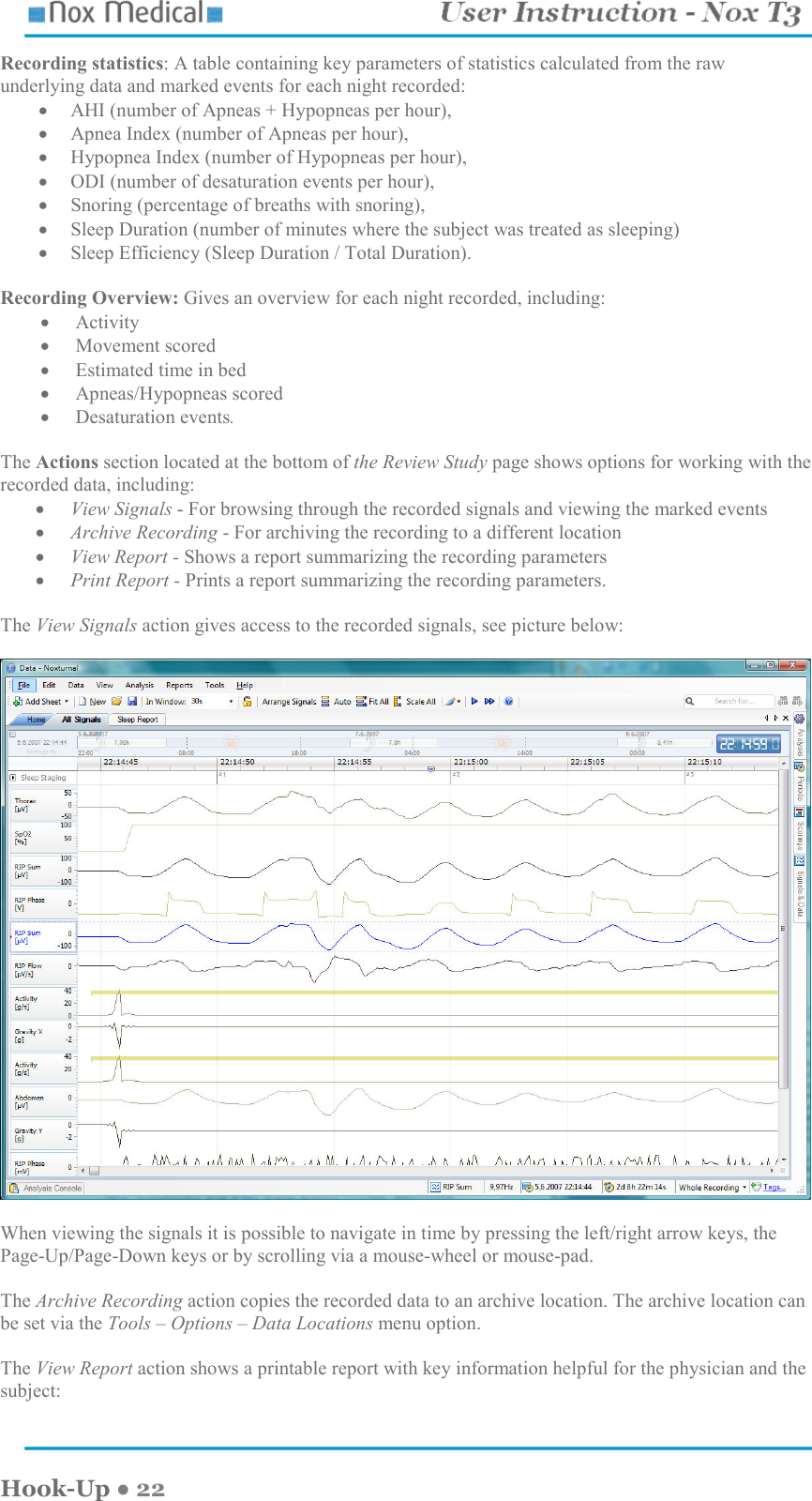    Hook-Up ● 22 Recording statistics: A table containing key parameters of statistics calculated from the raw underlying data and marked events for each night recorded:  • AHI (number of Apneas + Hypopneas per hour),  • Apnea Index (number of Apneas per hour),  • Hypopnea Index (number of Hypopneas per hour),  • ODI (number of desaturation events per hour),  • Snoring (percentage of breaths with snoring),  • Sleep Duration (number of minutes where the subject was treated as sleeping)  • Sleep Efficiency (Sleep Duration / Total Duration).  Recording Overview: Gives an overview for each night recorded, including: • Activity  • Movement scored • Estimated time in bed  • Apneas/Hypopneas scored  • Desaturation events.  The Actions section located at the bottom of the Review Study page shows options for working with the recorded data, including:  • View Signals - For browsing through the recorded signals and viewing the marked events • Archive Recording - For archiving the recording to a different location • View Report - Shows a report summarizing the recording parameters • Print Report - Prints a report summarizing the recording parameters.  The View Signals action gives access to the recorded signals, see picture below:    When viewing the signals it is possible to navigate in time by pressing the left/right arrow keys, the Page-Up/Page-Down keys or by scrolling via a mouse-wheel or mouse-pad.  The Archive Recording action copies the recorded data to an archive location. The archive location can be set via the Tools – Options – Data Locations menu option.  The View Report action shows a printable report with key information helpful for the physician and the subject: 