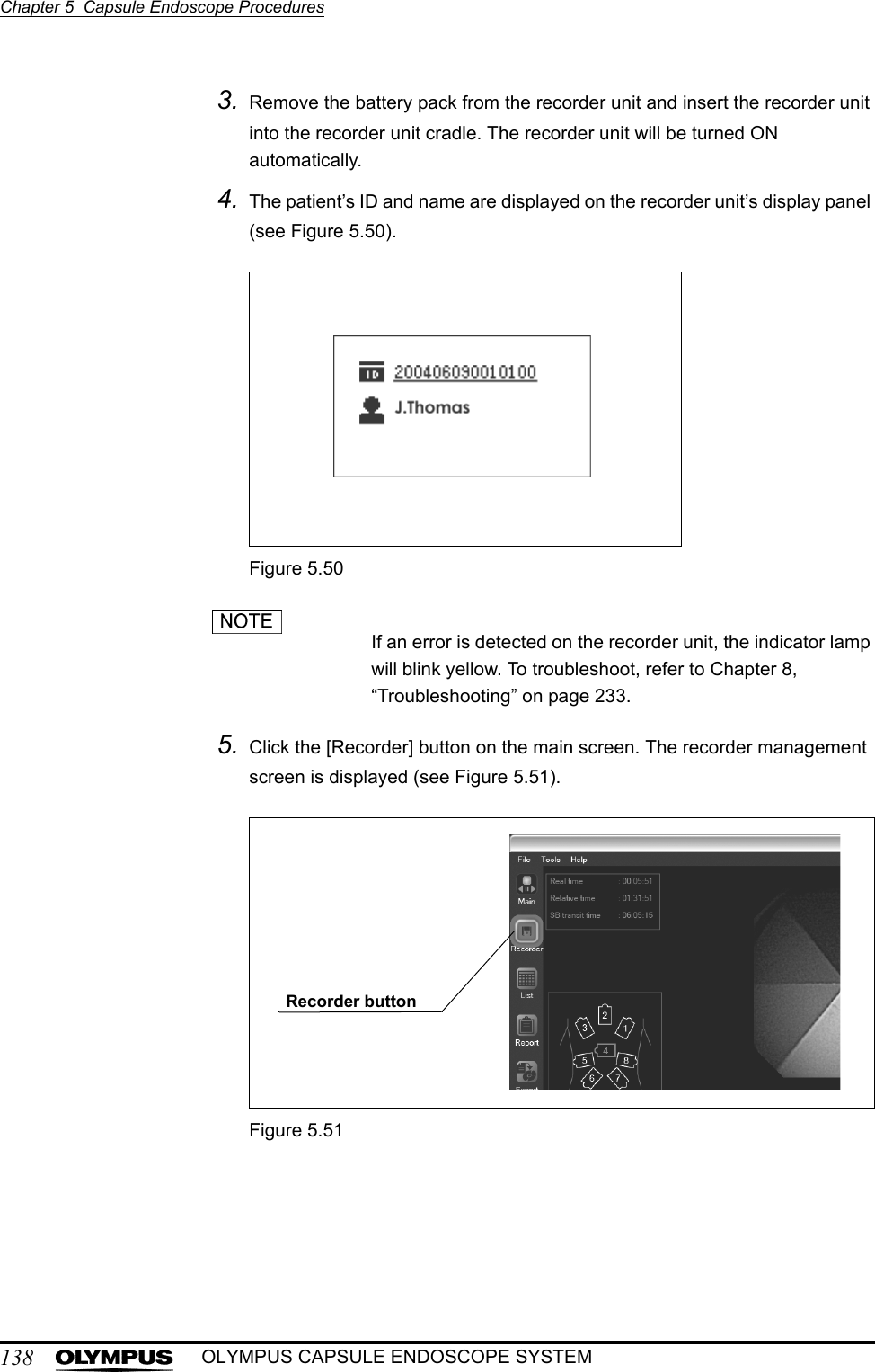 138Chapter 5  Capsule Endoscope ProceduresOLYMPUS CAPSULE ENDOSCOPE SYSTEM3. Remove the battery pack from the recorder unit and insert the recorder unit into the recorder unit cradle. The recorder unit will be turned ON automatically.4. The patient’s ID and name are displayed on the recorder unit’s display panel (see Figure 5.50).Figure 5.50If an error is detected on the recorder unit, the indicator lamp will blink yellow. To troubleshoot, refer to Chapter 8, “Troubleshooting” on page 233.5. Click the [Recorder] button on the main screen. The recorder management screen is displayed (see Figure 5.51).Figure 5.51Recorder button