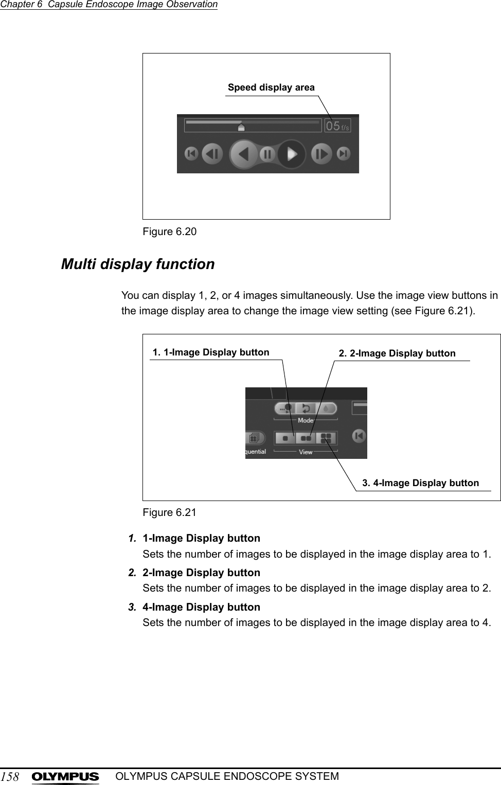 158Chapter 6  Capsule Endoscope Image ObservationOLYMPUS CAPSULE ENDOSCOPE SYSTEMFigure 6.20Multi display functionYou can display 1, 2, or 4 images simultaneously. Use the image view buttons in the image display area to change the image view setting (see Figure 6.21).Figure 6.211. 1-Image Display buttonSets the number of images to be displayed in the image display area to 1.2. 2-Image Display buttonSets the number of images to be displayed in the image display area to 2.3. 4-Image Display buttonSets the number of images to be displayed in the image display area to 4.Speed display area3. 4-Image Display button2. 2-Image Display button1. 1-Image Display button