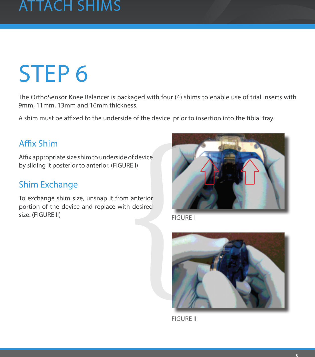 8STEP 6The OrthoSensor Knee Balancer is packaged with four (4) shims to enable use of trial inserts with 9mm, 11mm, 13mm and 16mm thickness.A shim must be axed to the underside of the device  prior to insertion into the tibial tray.ATTACH SHIMSAx ShimAx appropriate size shim to underside of device by sliding it posterior to anterior. (FIGURE I)Shim ExchangeTo exchange shim size, unsnap it from anterior portion of the device and replace with desired size. (FIGURE II) FIGURE IFIGURE II