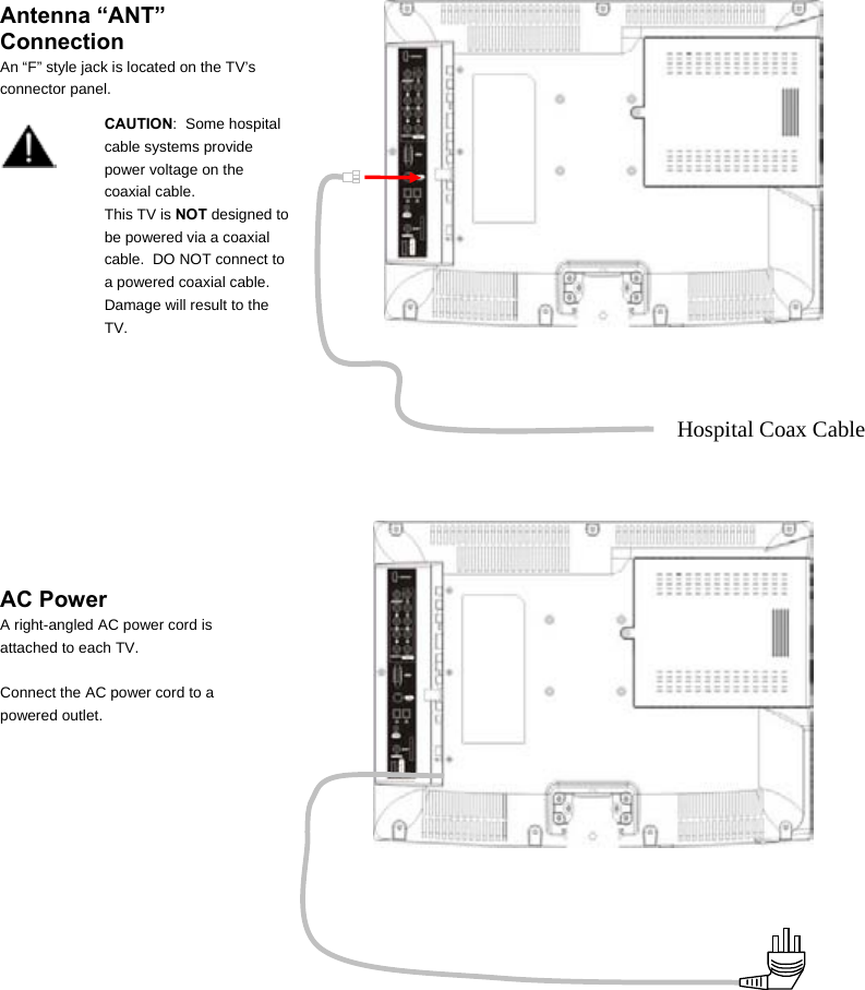  Antenna “ANT” Connection An “F” style jack is located on the TV’s connector panel.  CAUTION:  Some hospital cable systems provide power voltage on the coaxial cable.    This TV is NOT designed to be powered via a coaxial cable.  DO NOT connect to a powered coaxial cable.  Damage will result to the TV.       Hospital Coax Cable     AC Power A right-angled AC power cord is attached to each TV.    Connect the AC power cord to a powered outlet.       