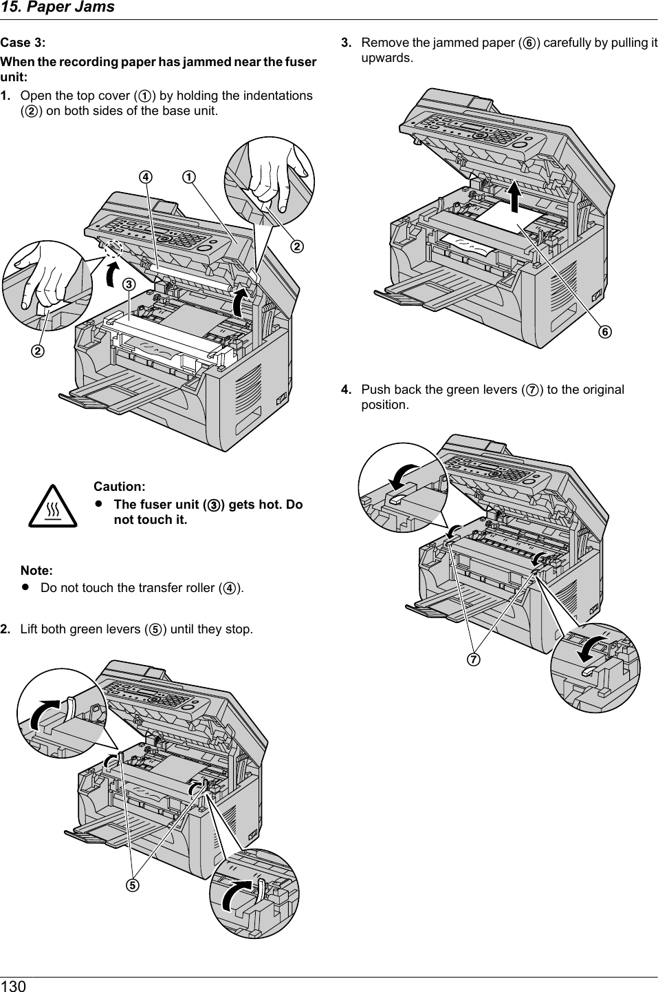 Case 3:When the recording paper has jammed near the fuserunit:1. Open the top cover (A) by holding the indentations(B) on both sides of the base unit.DABBCCaution:RThe fuser unit (C) gets hot. Donot touch it.Note:RDo not touch the transfer roller (D).2. Lift both green levers (E) until they stop.E3. Remove the jammed paper (F) carefully by pulling itupwards.F4. Push back the green levers (G) to the originalposition.G13015. Paper Jams