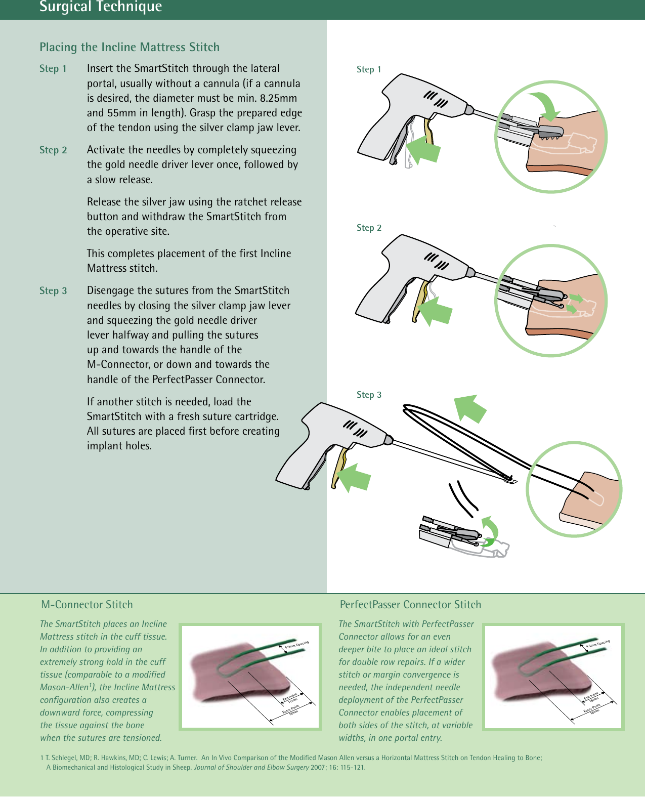 Arthrocare Auto Cuff Technique Guide