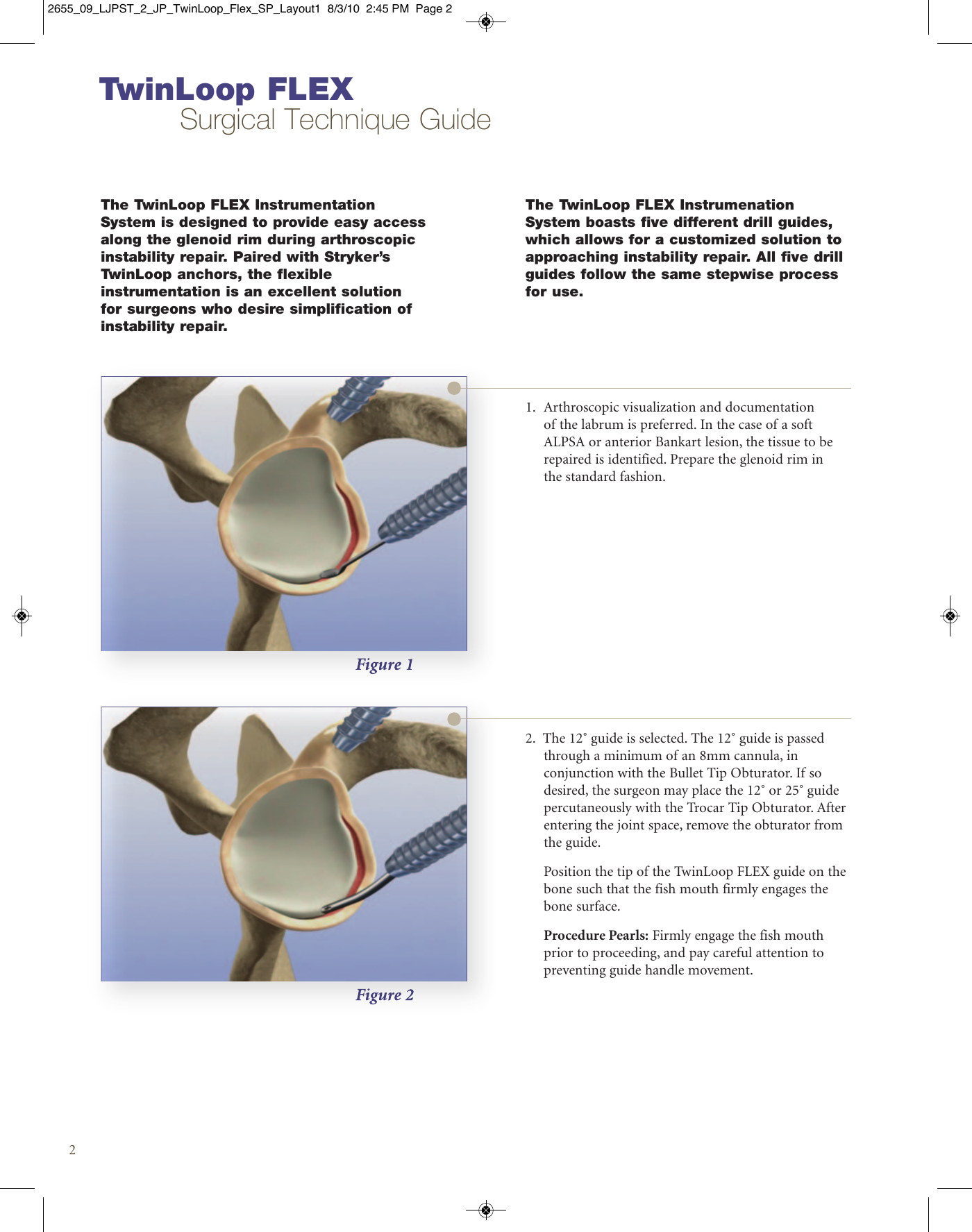 Page 2 of 8 - Stryker Brochure - Plastic Coil  Flex Instability Surgical Technique