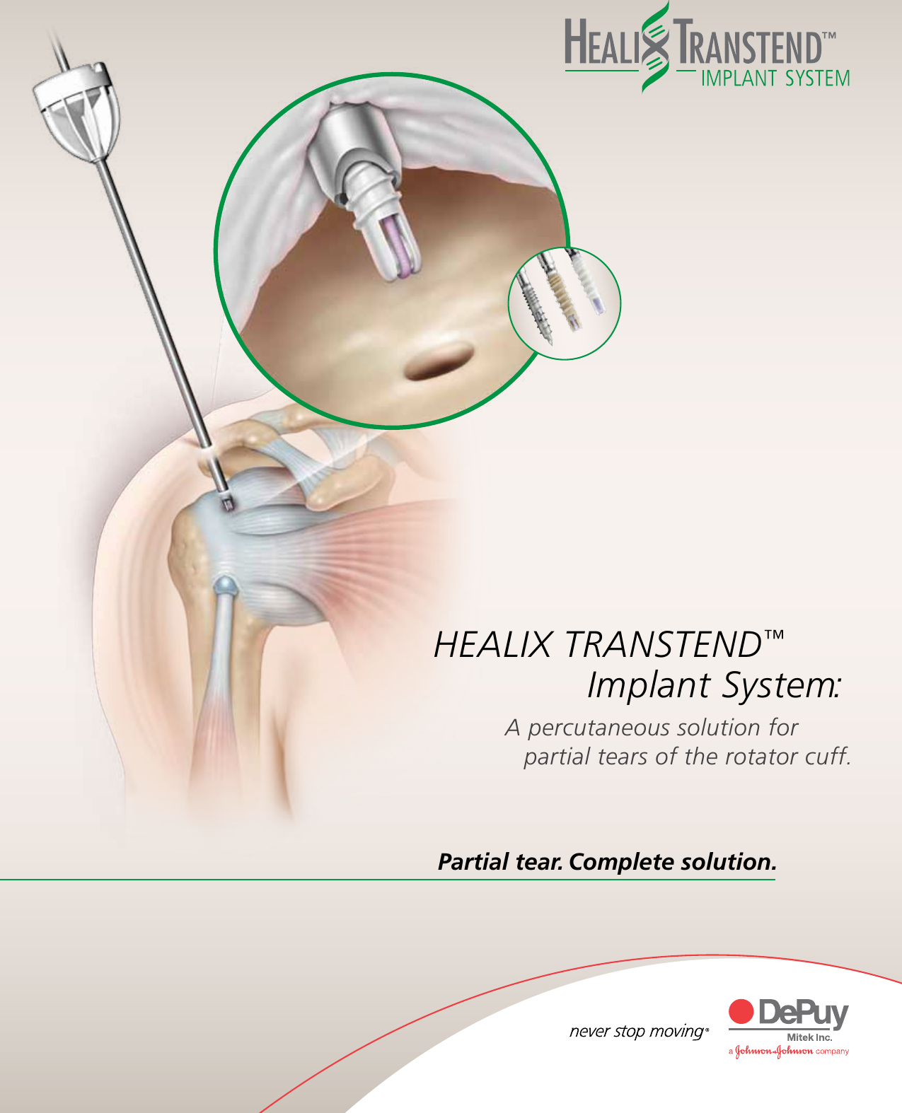 Page 1 of 12 - HEALIX TRANSTEND Implant System Brochure