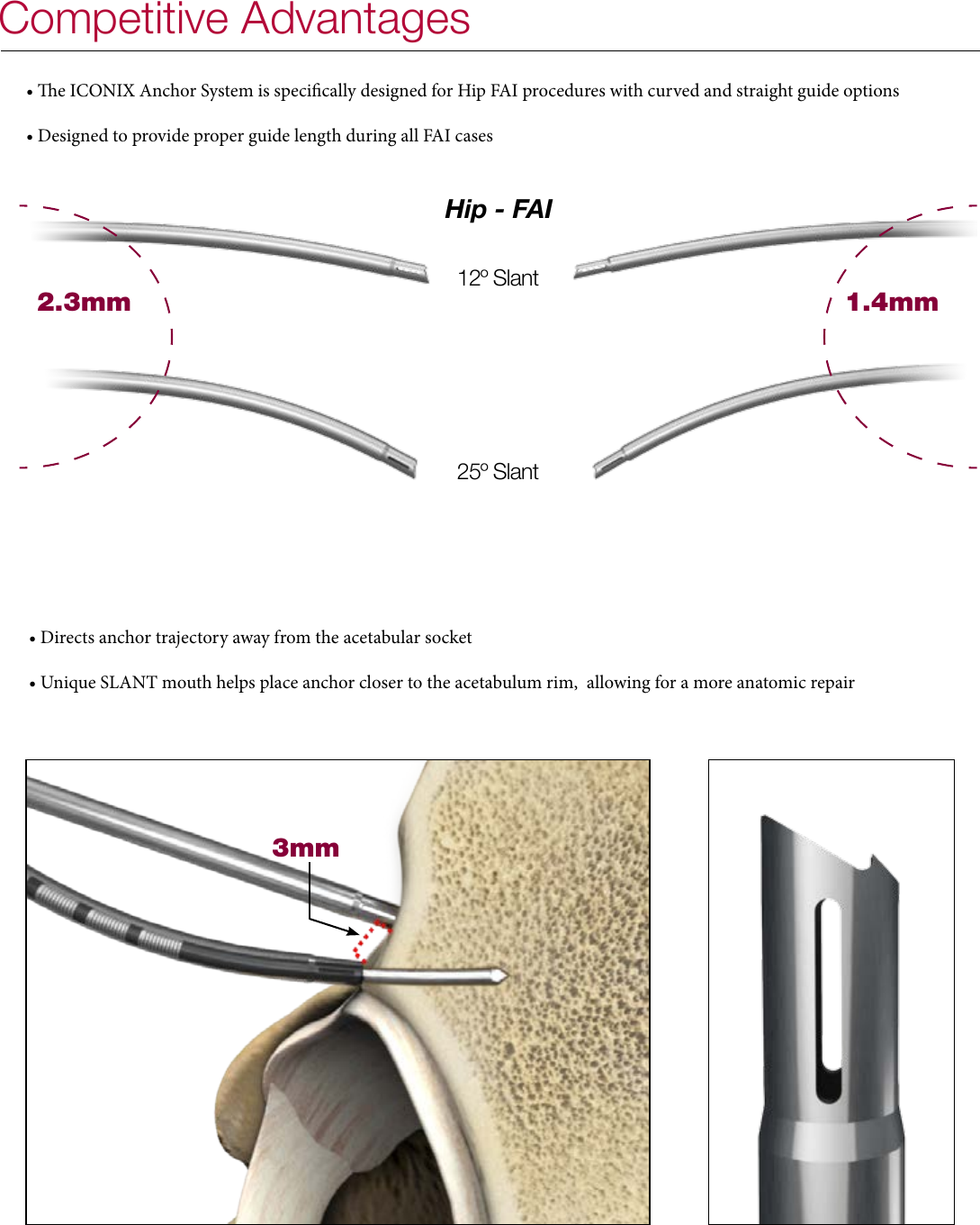 Page 5 of 8 - Iconix All Suture Anchor Brochure