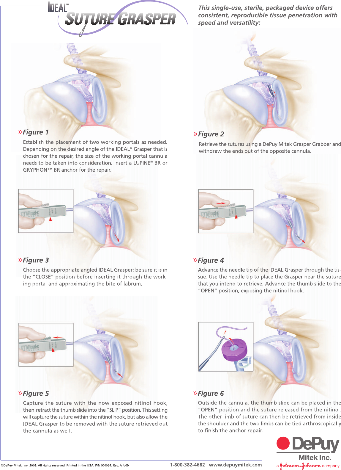 Page 2 of 2 - 8083A_Chia_SellSheet  Ideal Grasper Surgical Technique