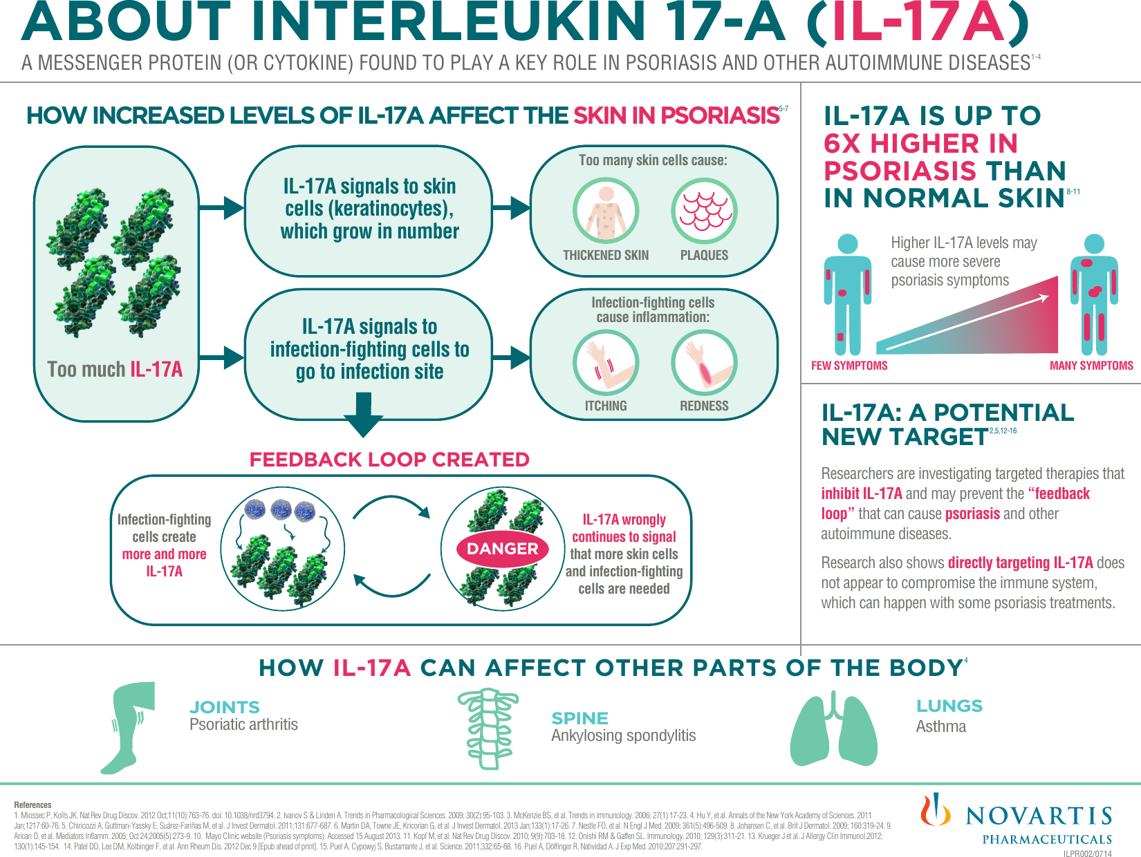 Page 1 of 1 - IL-17_Infographic_R13_SF Copy  IL-17A Infographic