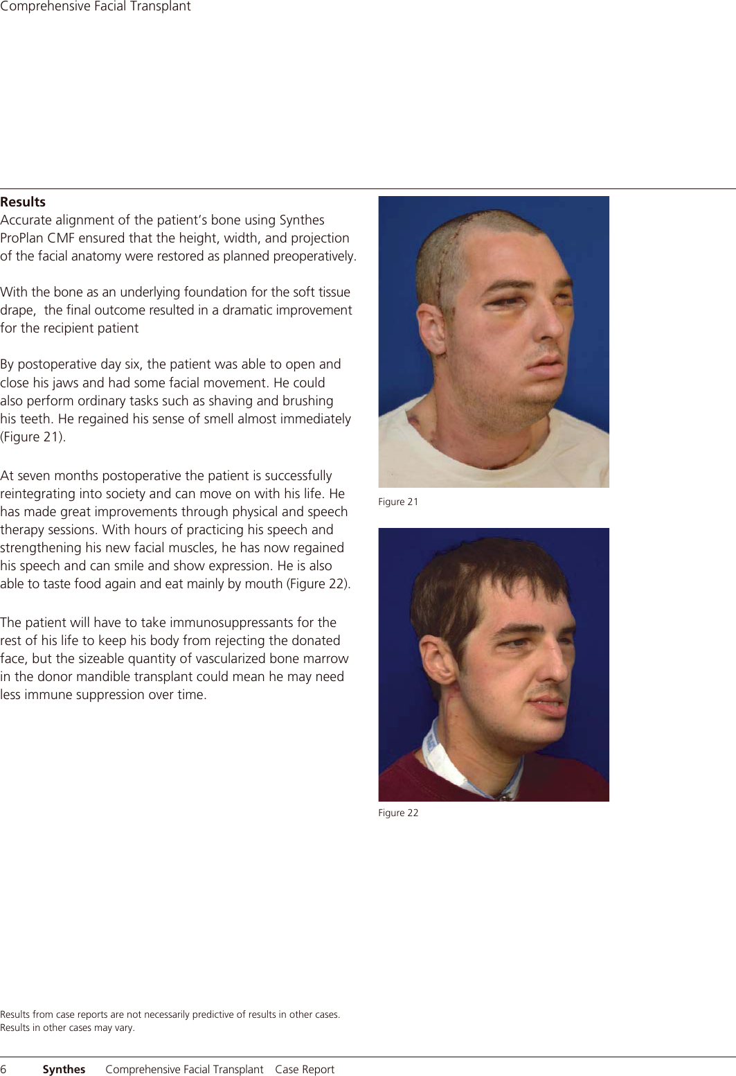 Page 8 of 12 - 11702A_LoRes For Reference  MXCSComp Facial Trans J11702A