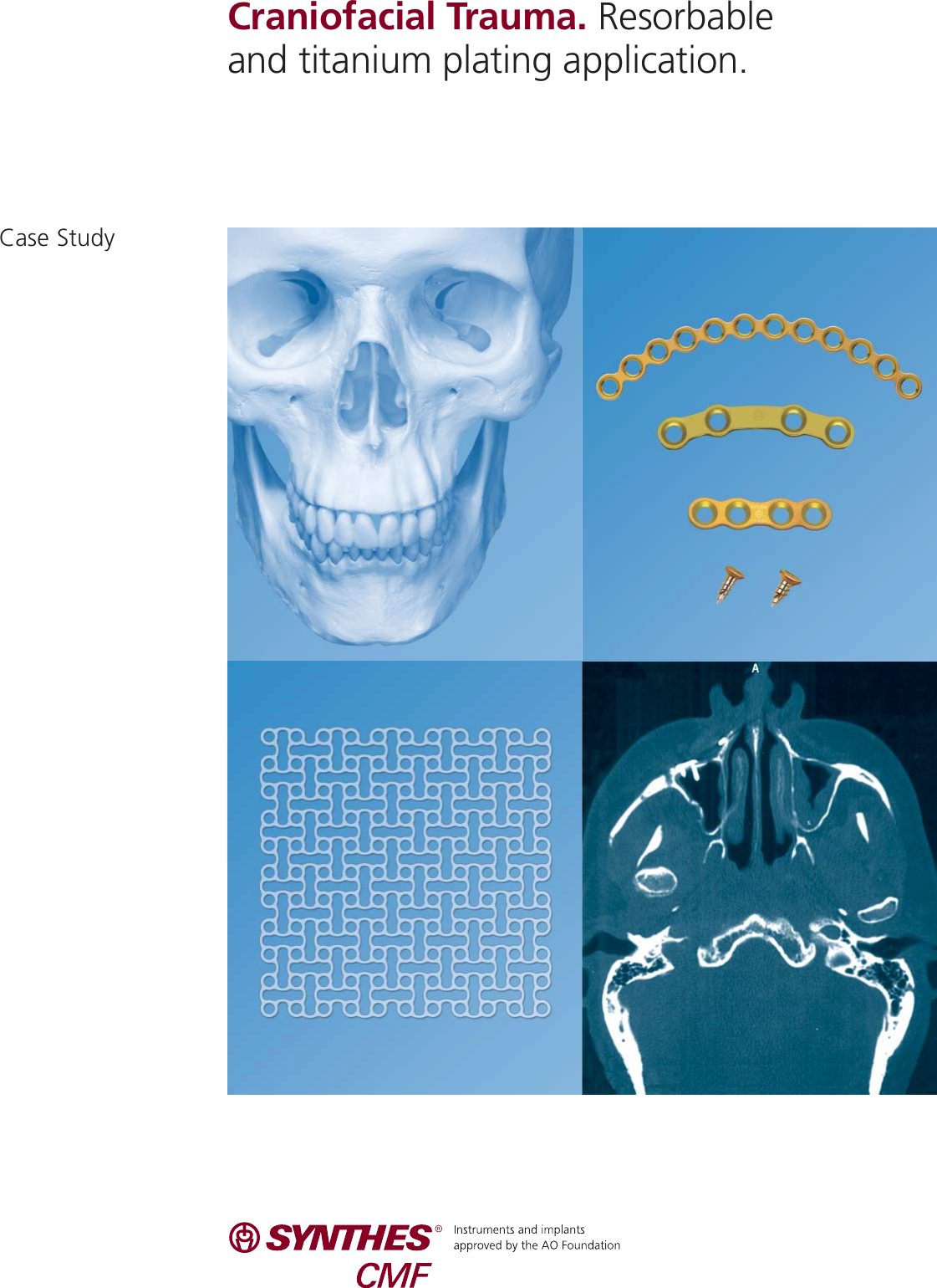 Page 1 of 4 - Craniofacial Trauma Case Study  MXCSCraniofacial J6819B