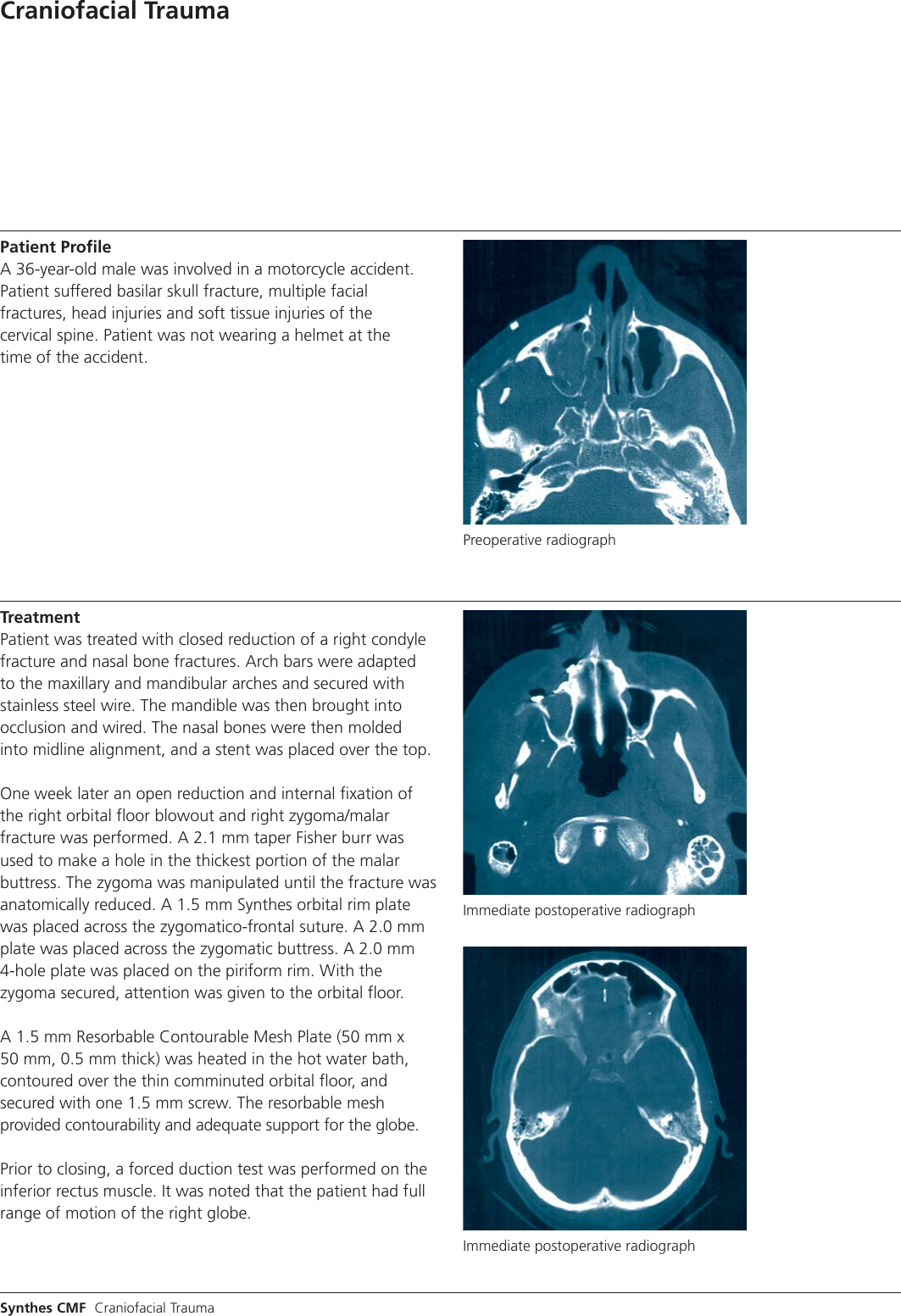 Page 2 of 4 - Craniofacial Trauma Case Study  MXCSCraniofacial J6819B
