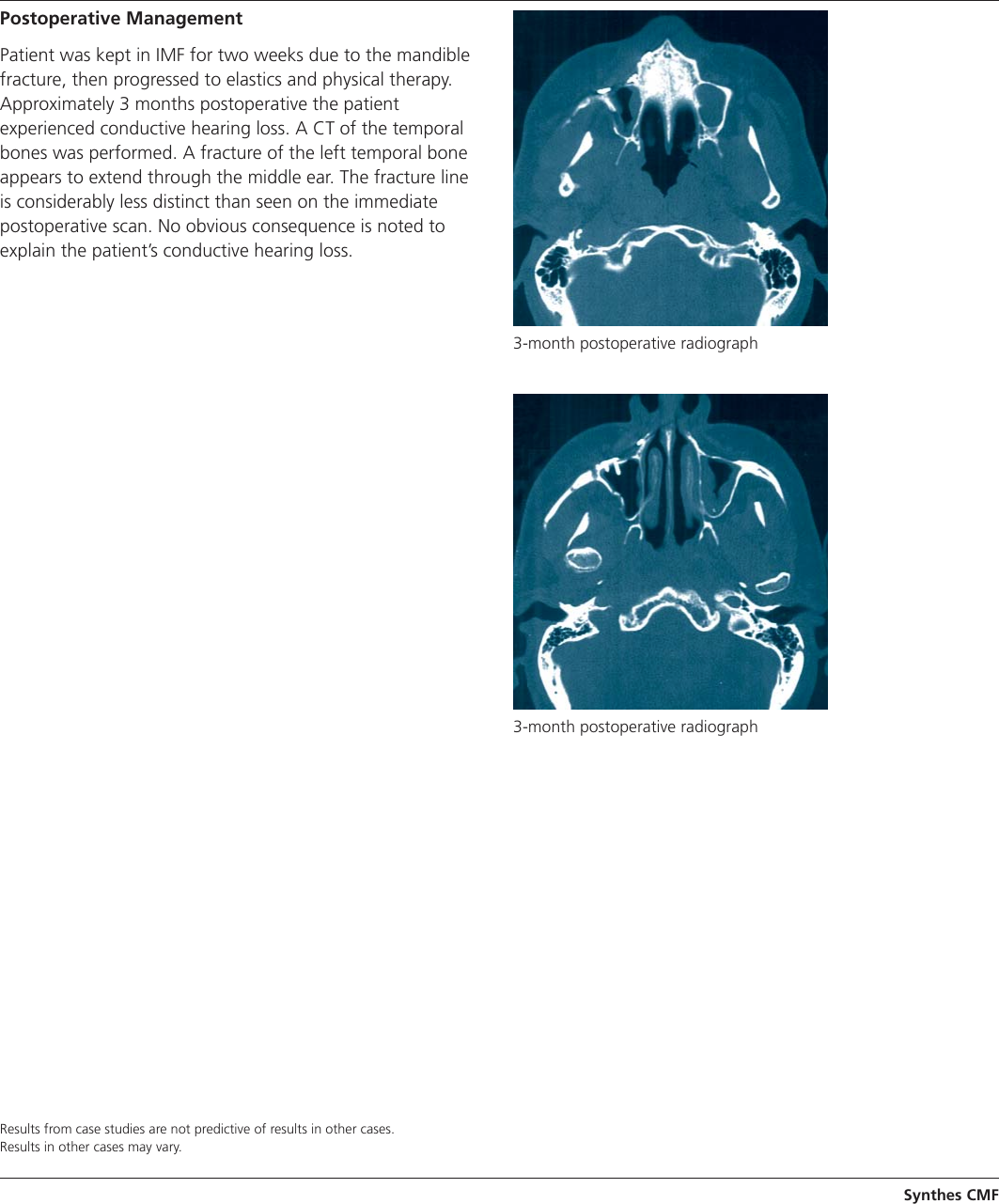 Page 3 of 4 - Craniofacial Trauma Case Study  MXCSCraniofacial J6819B